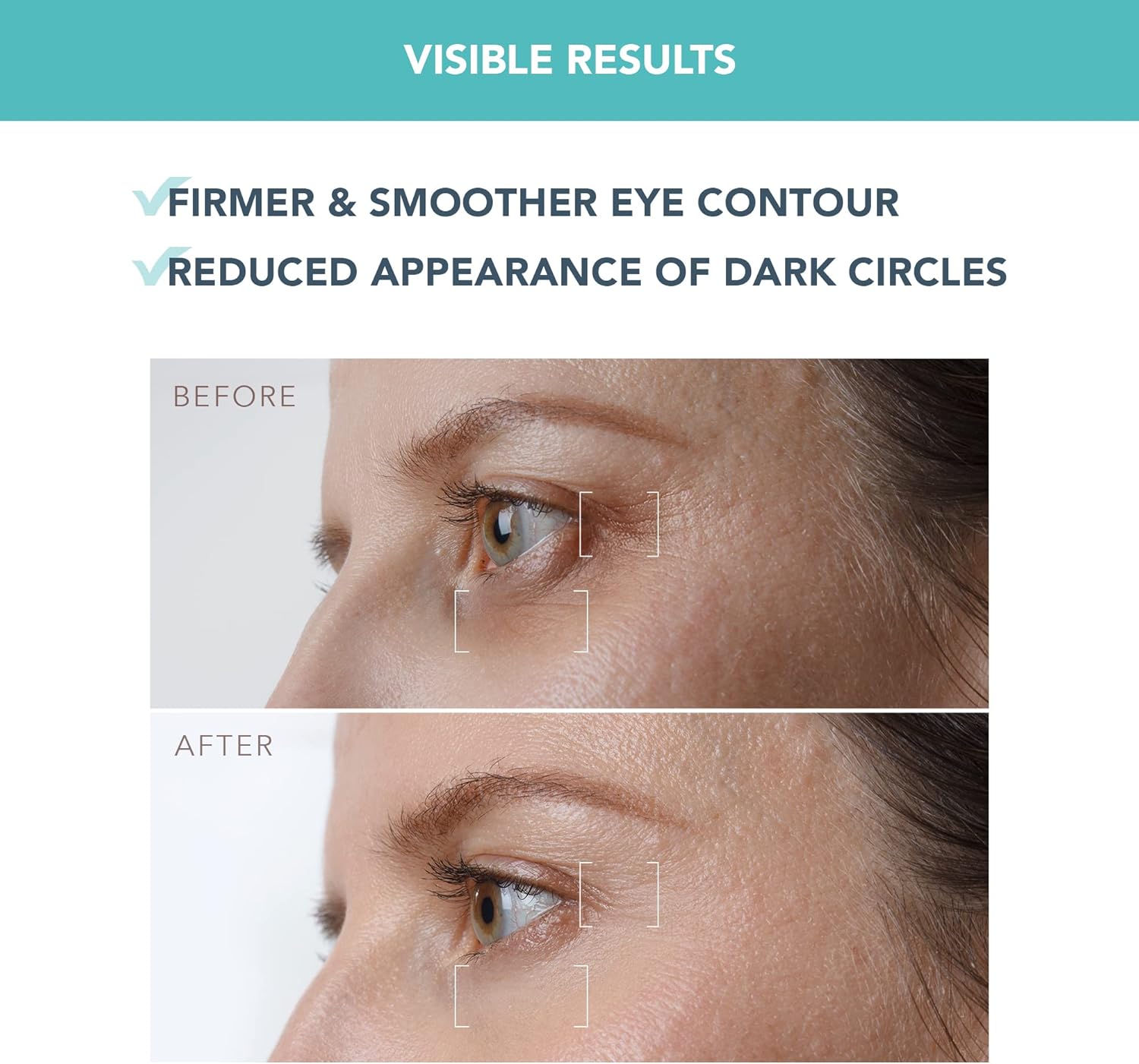 Thumbnail 3 de IRIS Sérum contour des yeux fermeté nuit (rétinol, bakuchiol) – anti-cerne, poches et rides – 15 ml