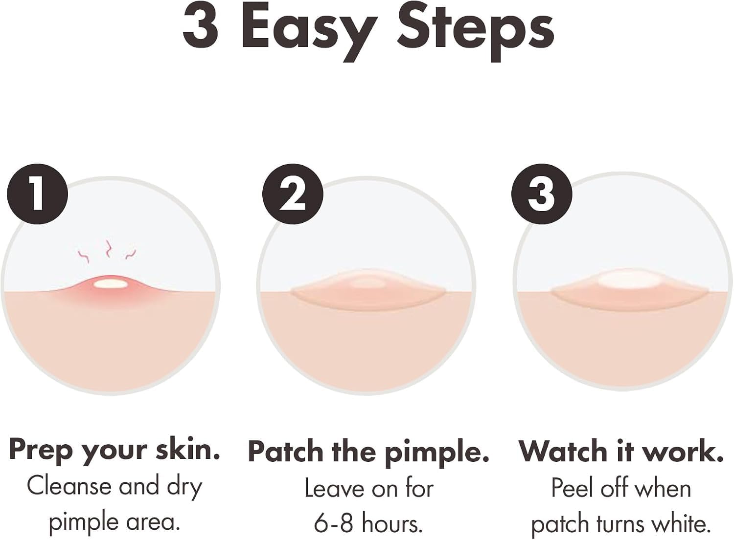 Detalle 2 de Mighty Patch Original Spot Patches by HERO COSMETICS (36 patches) – Overnight Hydrocolloid Acne Treatment