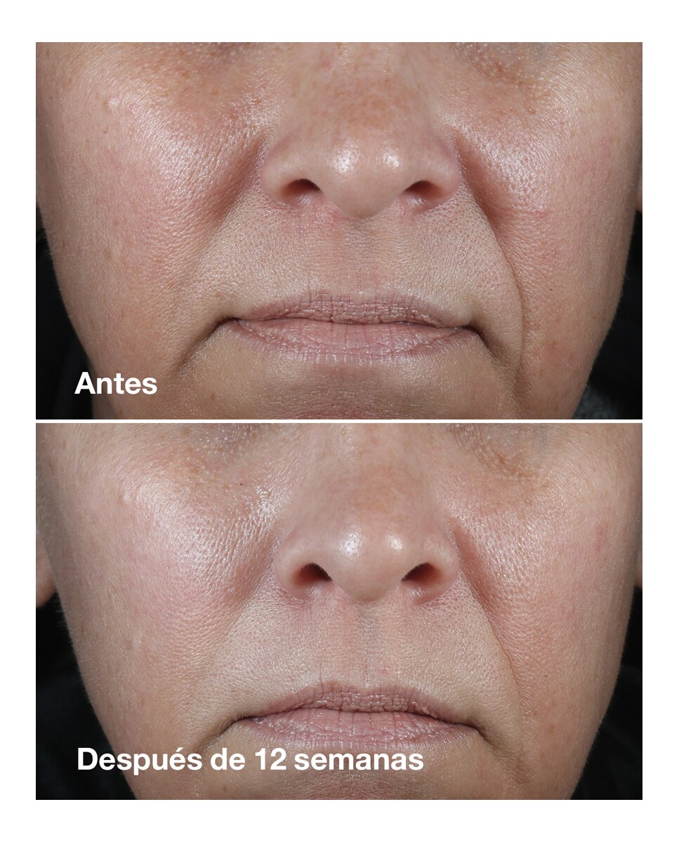 Thumbnail 2 de Clinique Wrinkle Correcting Rich Cream 50 ml crema