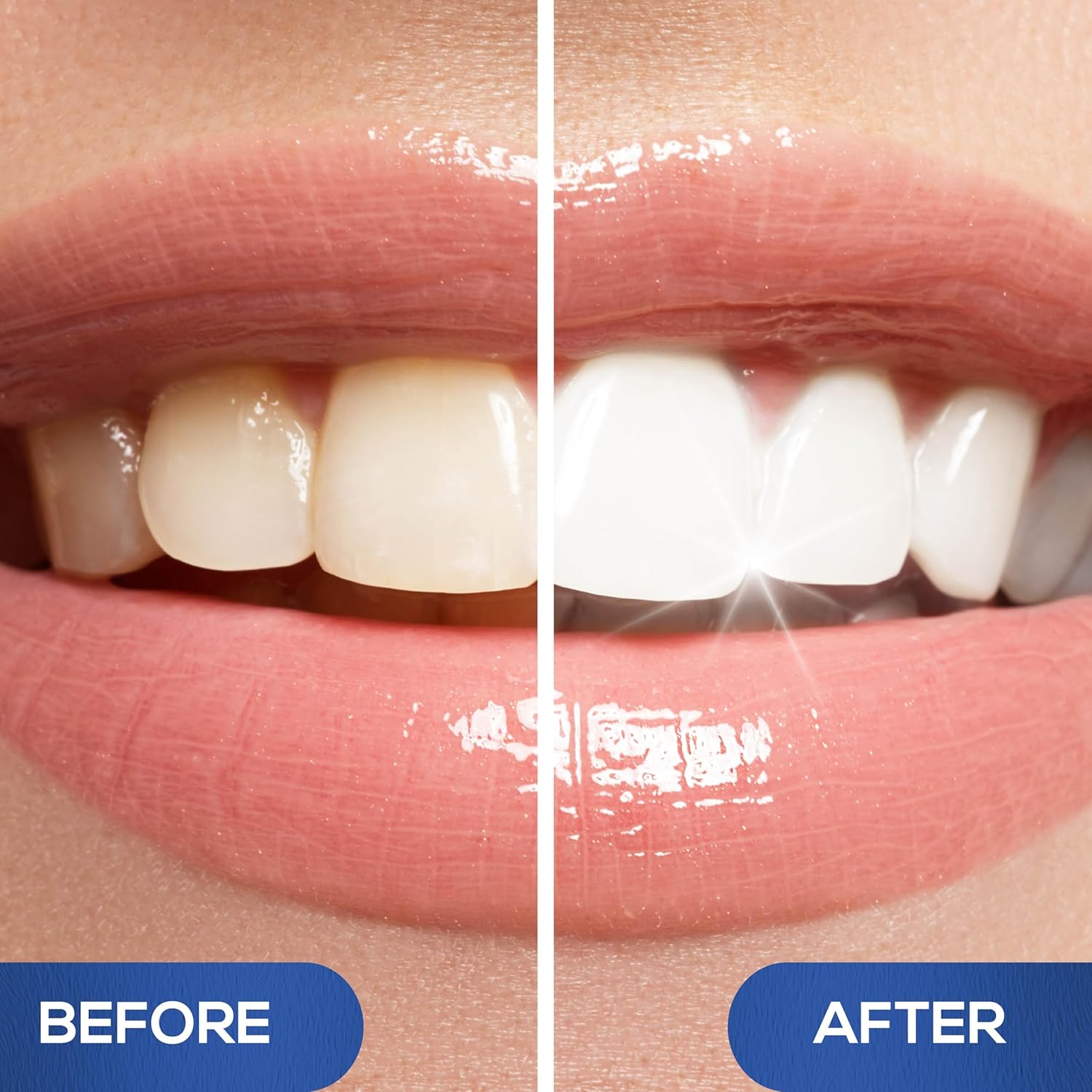 Detalle de Venus Visage Teeth Whitening Pen, 20+ Uses ⚙
