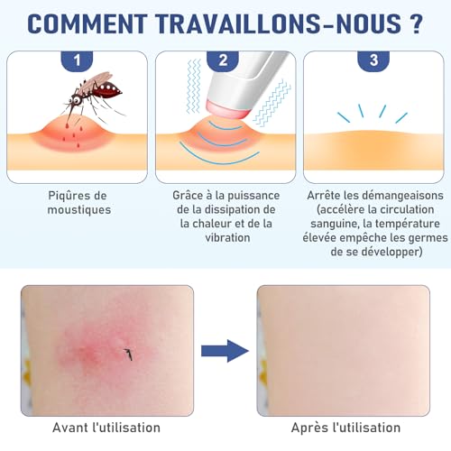 Detalle de ICARe Stylo chauffant anti-piqûres d'insectes – rechargeable, 4 niveaux de chaleur