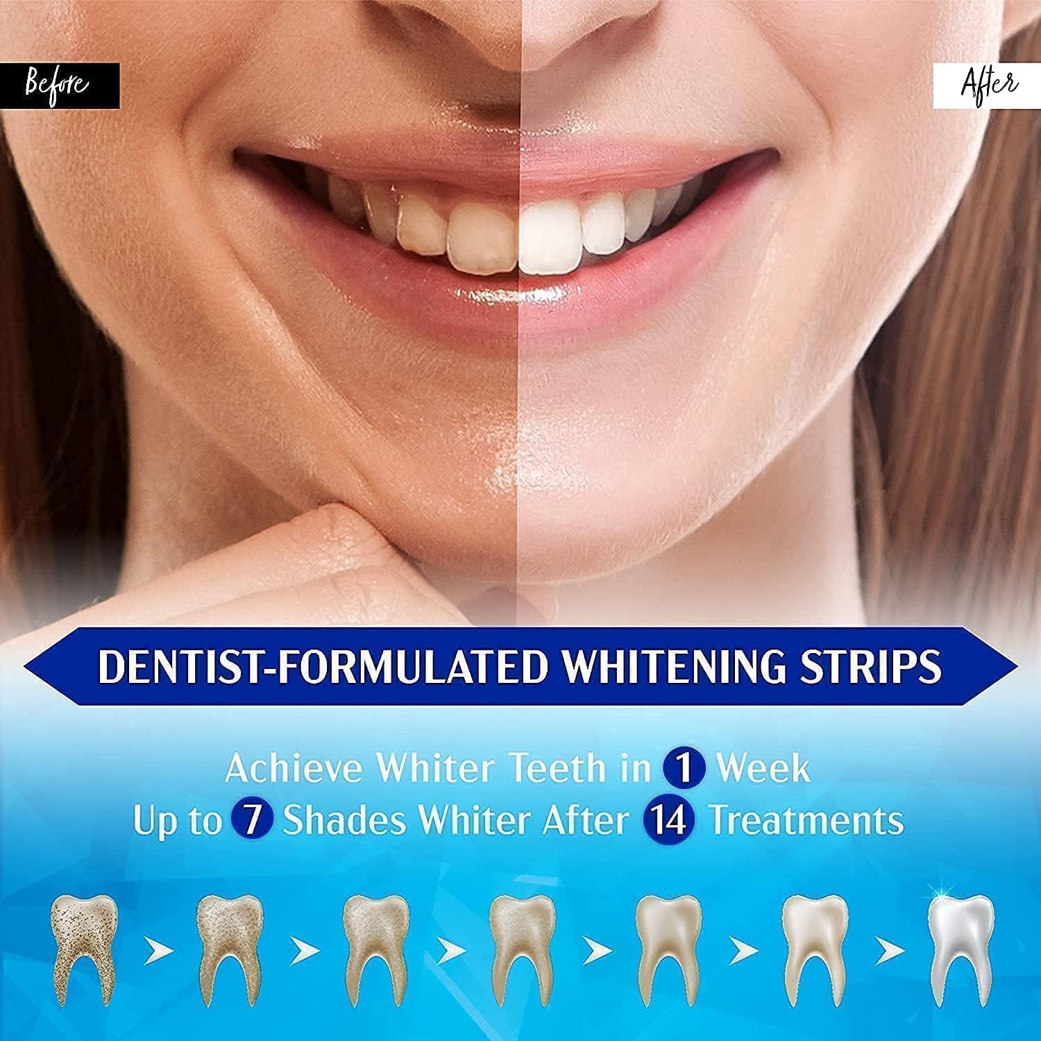 Detalle de Celakeety White Stripes Zahnaufhellung – Bleaching Stripes für zu Hause