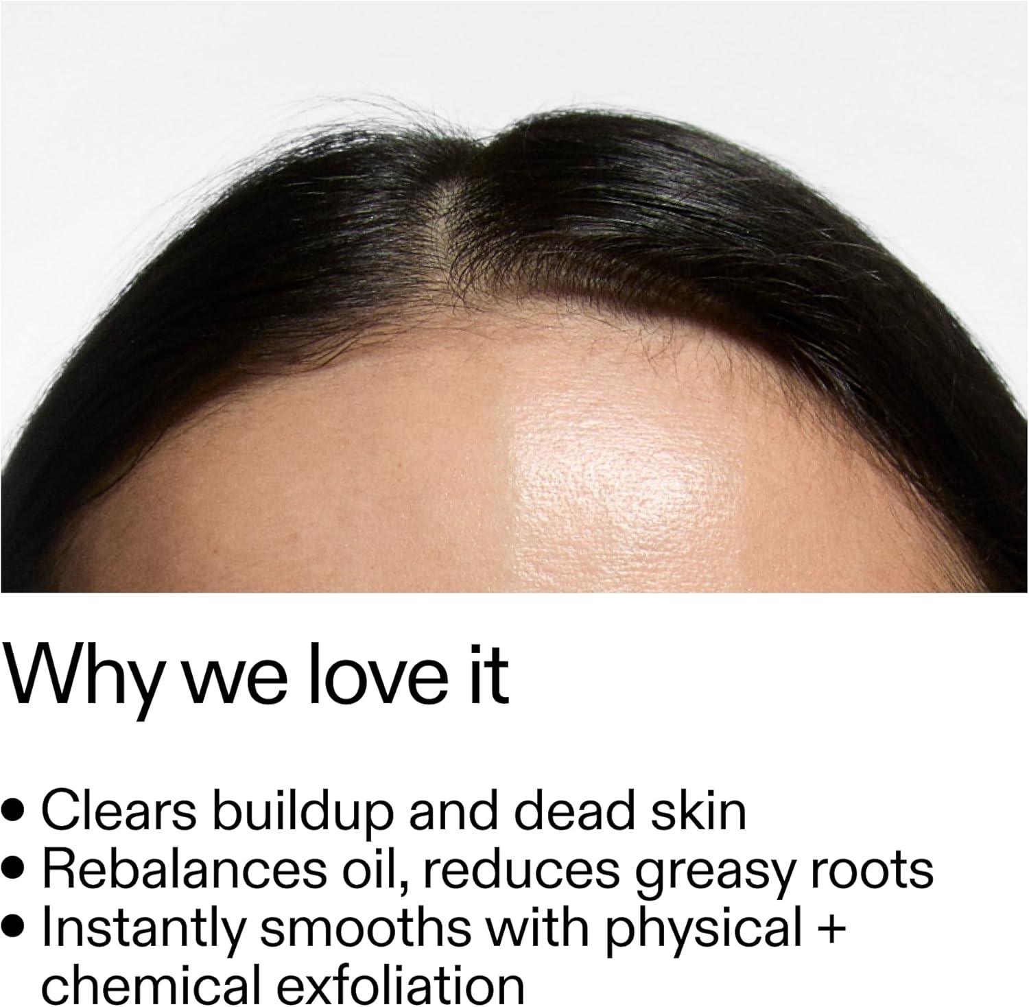 Thumbnail 1 de The INKEY List Exfoliante de Cuero Cabelludo con Ácido Glicólico 🌿, 150 ml