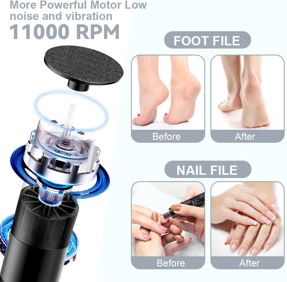 Thumbnail 5 de AOOWU Pedicure Elettrico Professionale 9 velocità 🦶