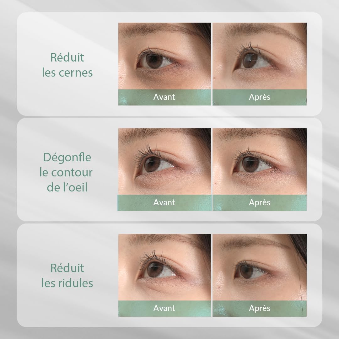 Detalle de MIZON Cicaluronic Patchs yeux dégonflants 42 💧