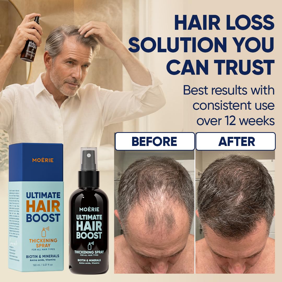 Detalle de Moerie Hair Growth Serum Spray for Men and Women: Biotin & Rosemary Formula for Thicker, Healthier Hair