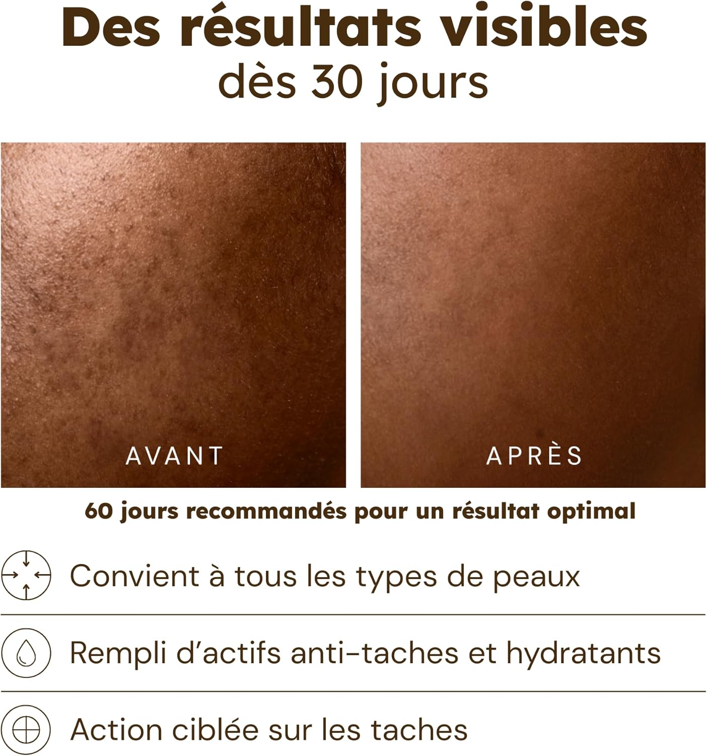 Detalle de Séfia Sérum Anti-Imperfections Visage 30 ml – Curcuma, Vitamine C et AHA pour un teint plus homogène