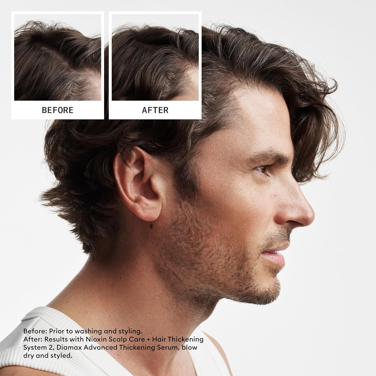 Detalle 2 de NIOXIN Scalp + Hair Thickening System Kit