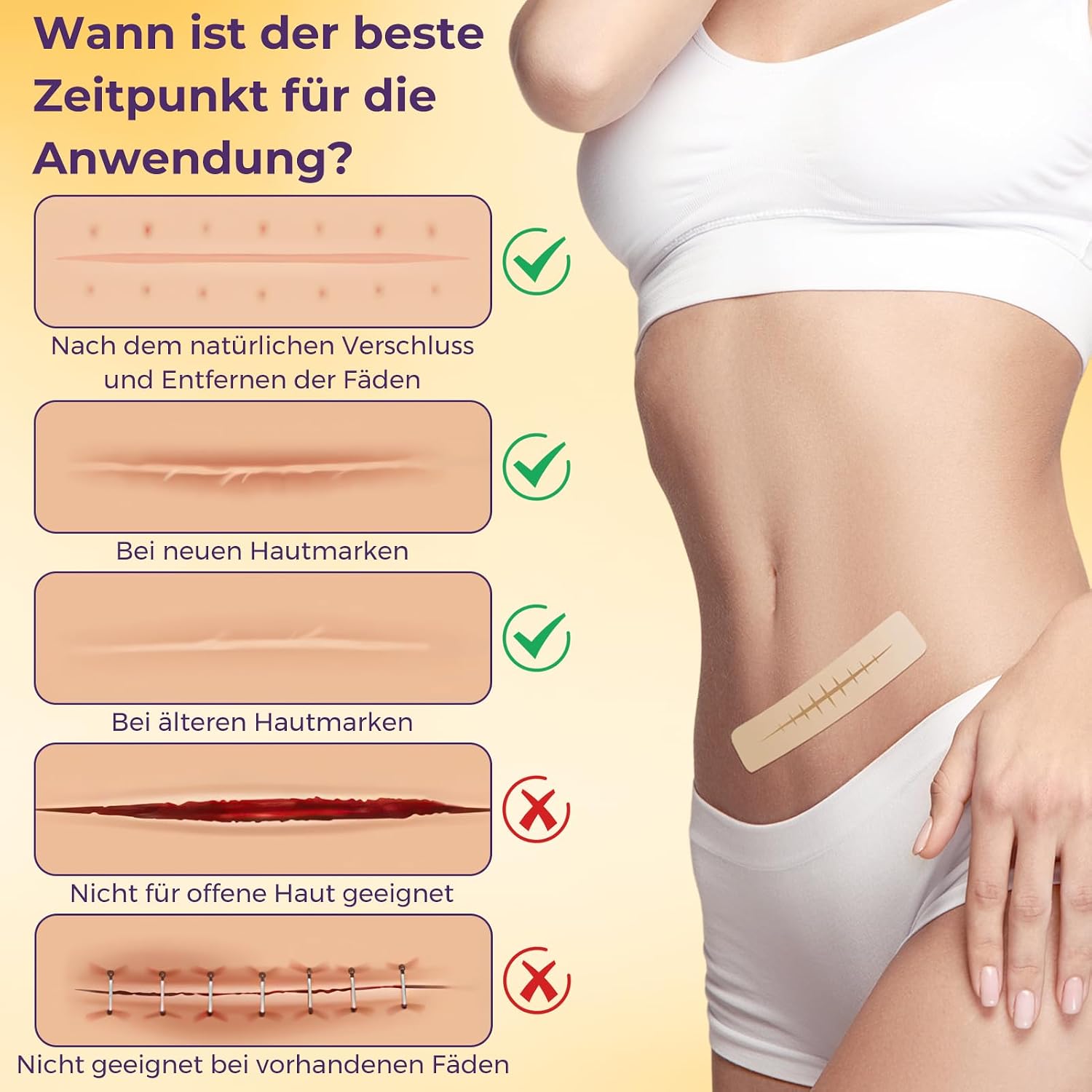 Detalle de Silikon Narbenpflaster 4 cm × 300 cm – wiederverwendbar, hautfarben, wasserdicht und atmungsaktiv