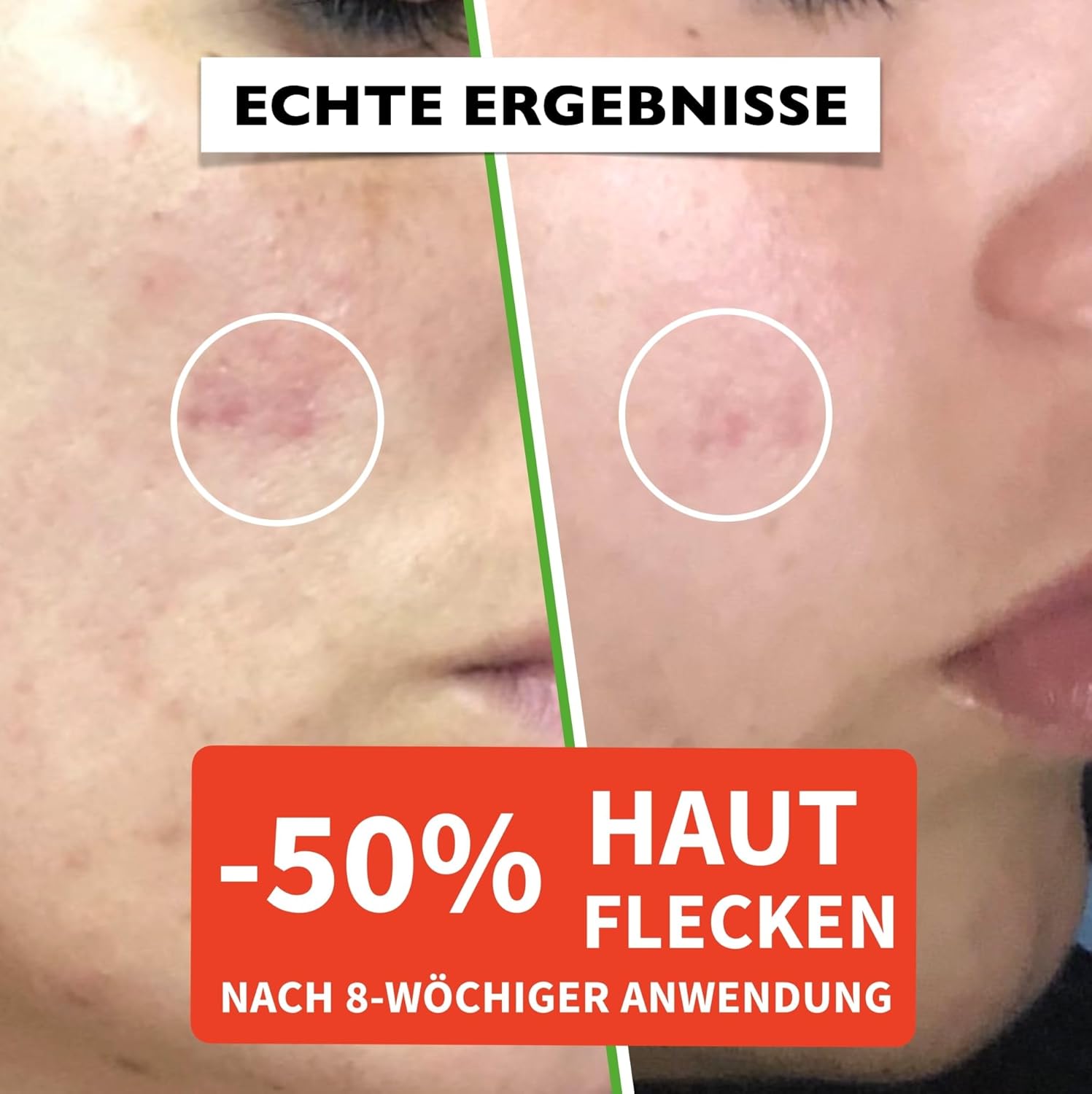 Detalle 2 de Bio Hyaluron Serum 60 ml – Anti-Aging Gesichtsserum