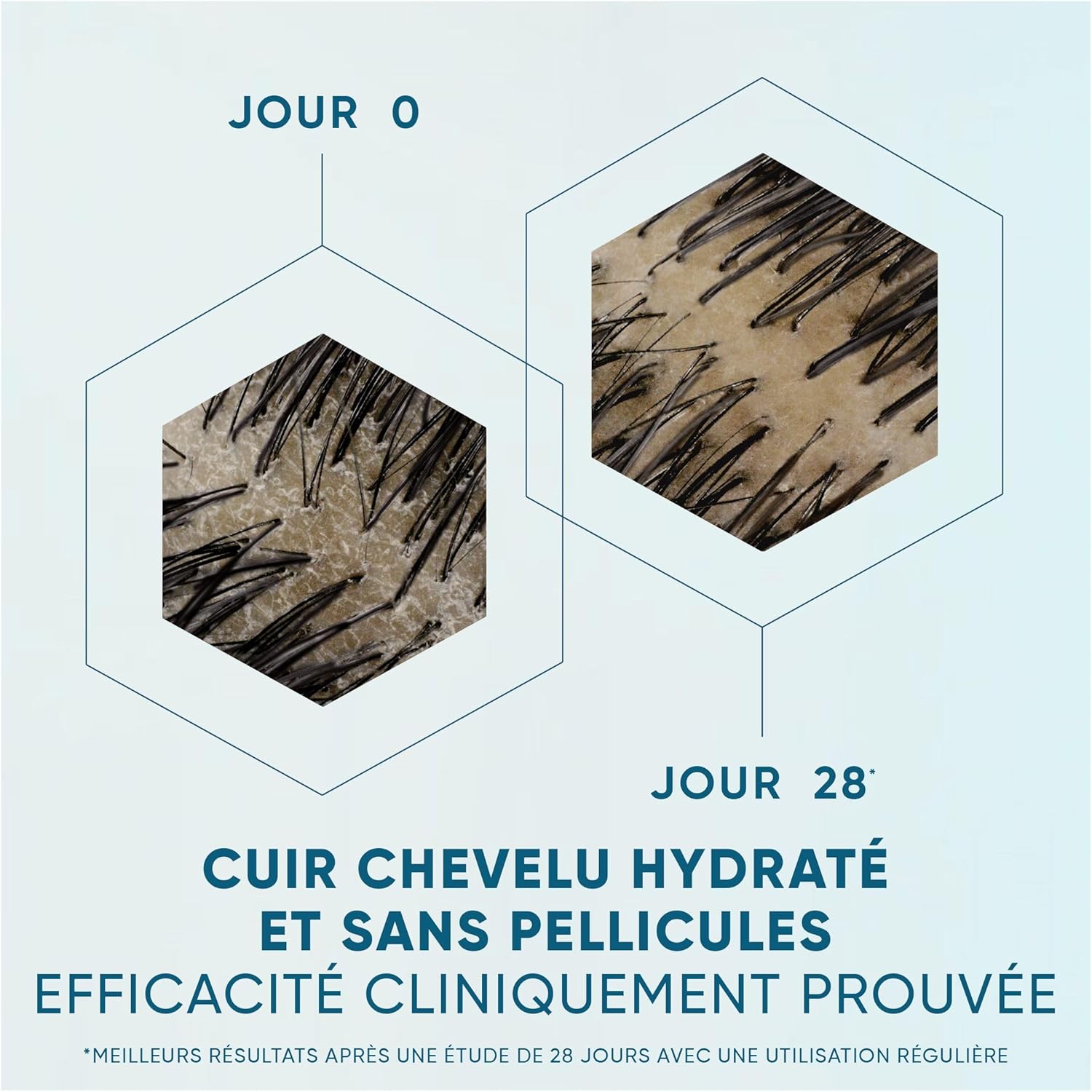 Thumbnail 5 de DermaXPRO Shampoing Sans Sulfates 250 mL – Hydratant et apaisant pour cuir chevelu sensible