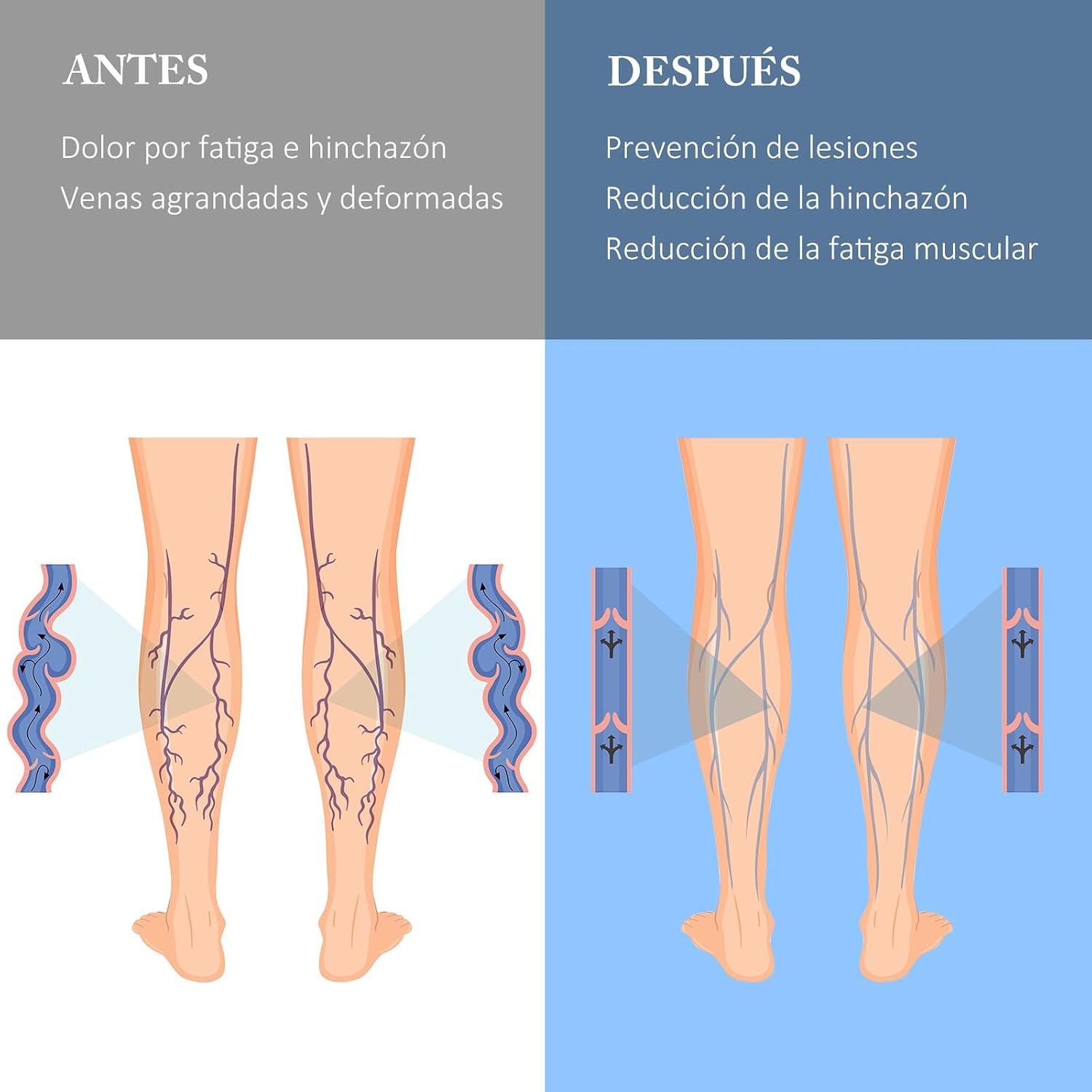Detalle 2 de ZFSOCK Calcetines Compresión 20-30 mmHg
