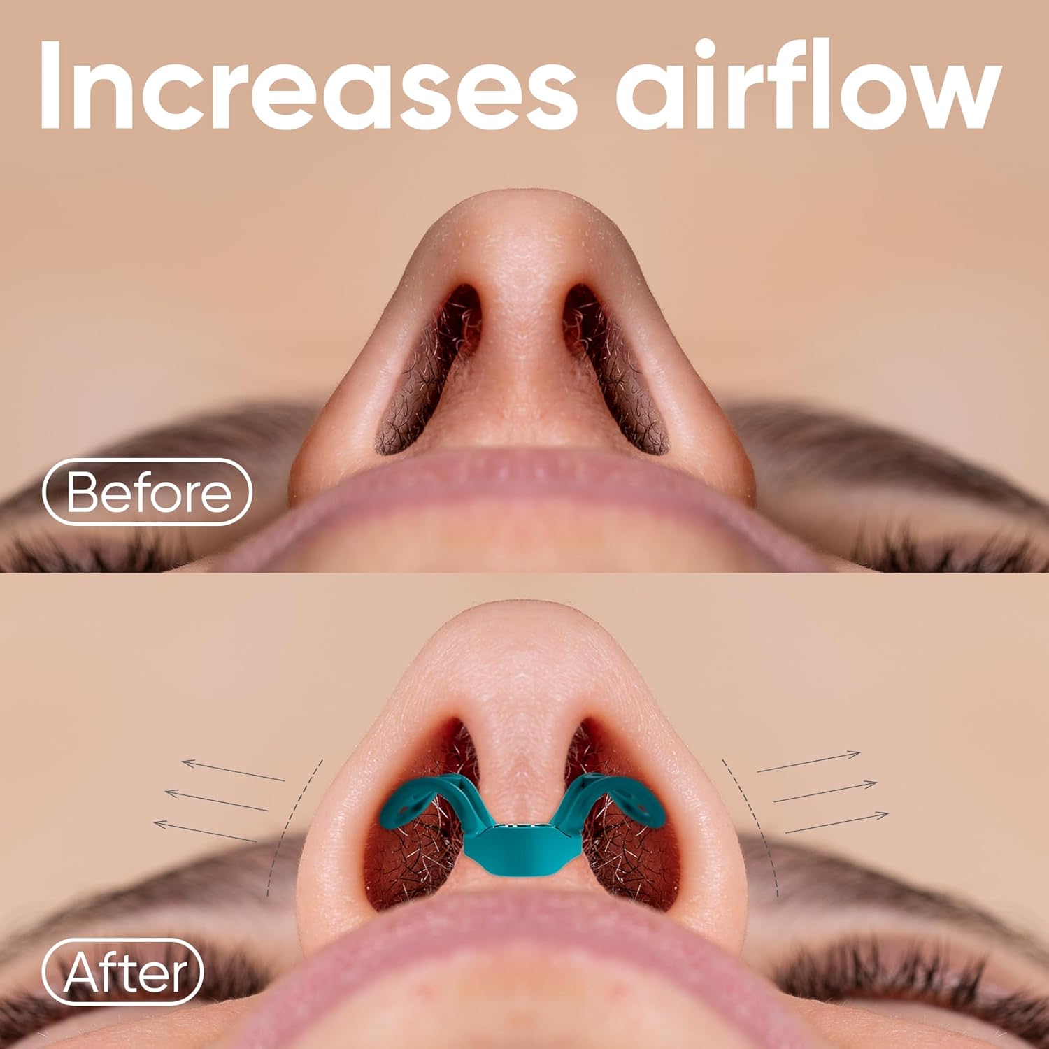 Thumbnail 2 de Brison Nasal Dilators 2-pack anti-snoring nose vents 😷
