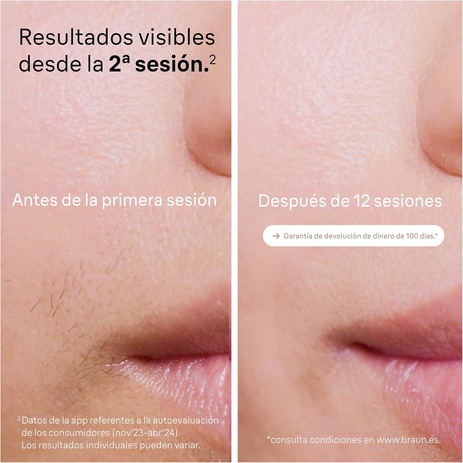 Thumbnail 2 de Braun Silk‑expert Pro 5 PL5157 depiladora IPL 5 niveles