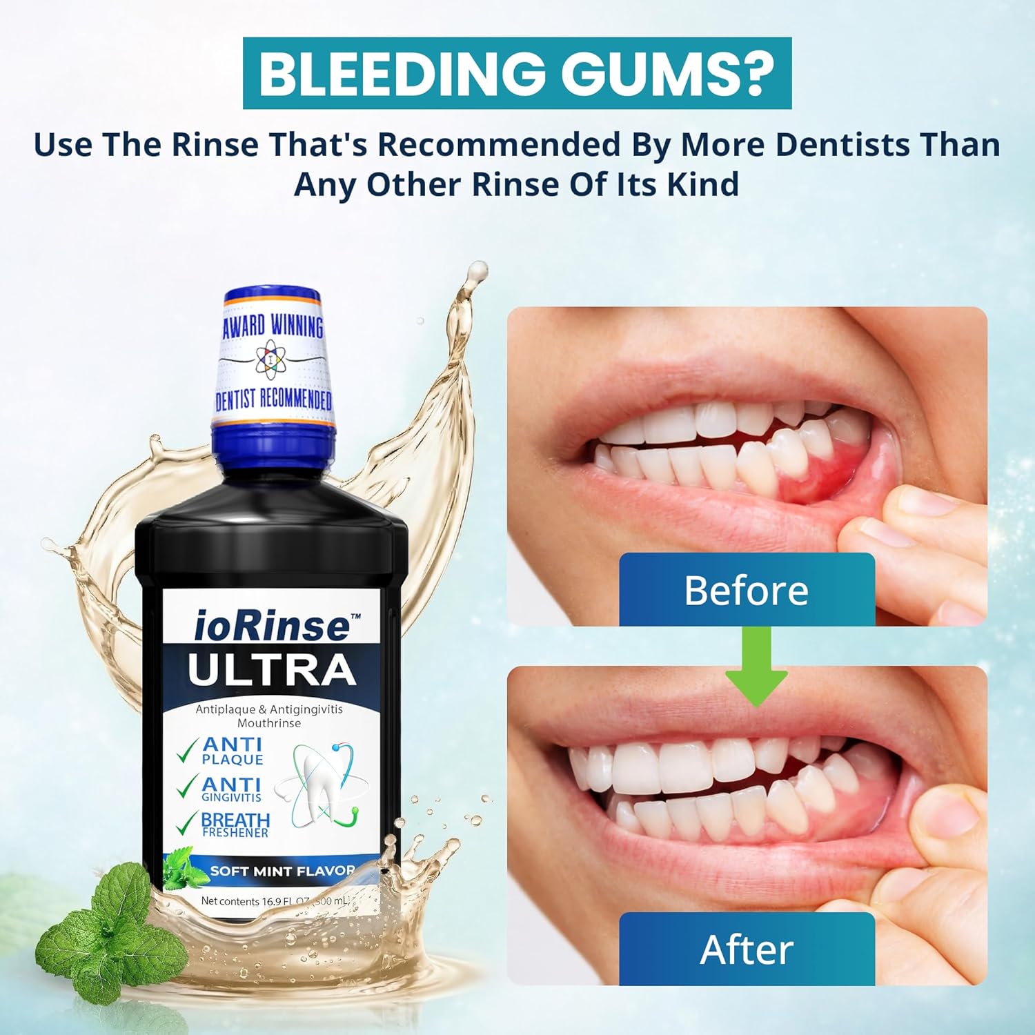 Thumbnail 2 de ioRinse Ultra Periodontal Rinse & Gum Mouthwash (Alcohol-Free) with Molecular Iodine & Xylitol, 1L