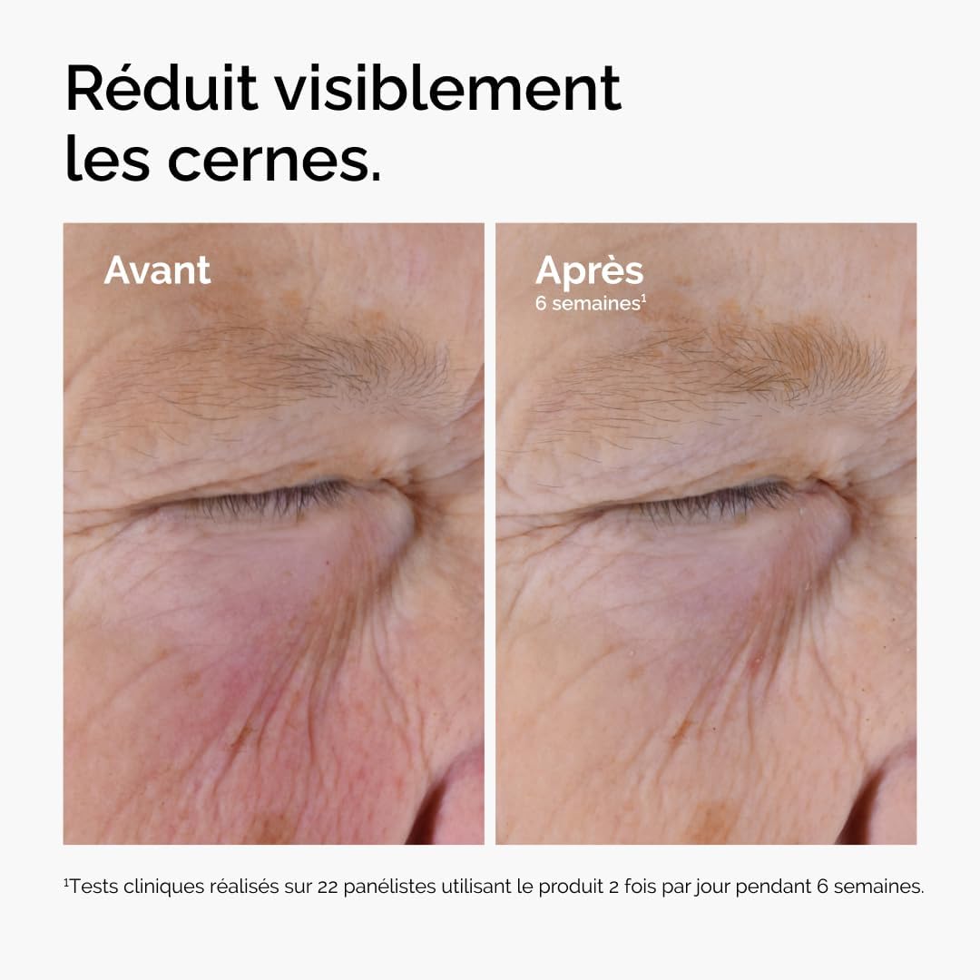 Detalle 2 de The Ordinary Solution à la Caféine 5% + EGCG – Sérum contour des yeux, 30 ml