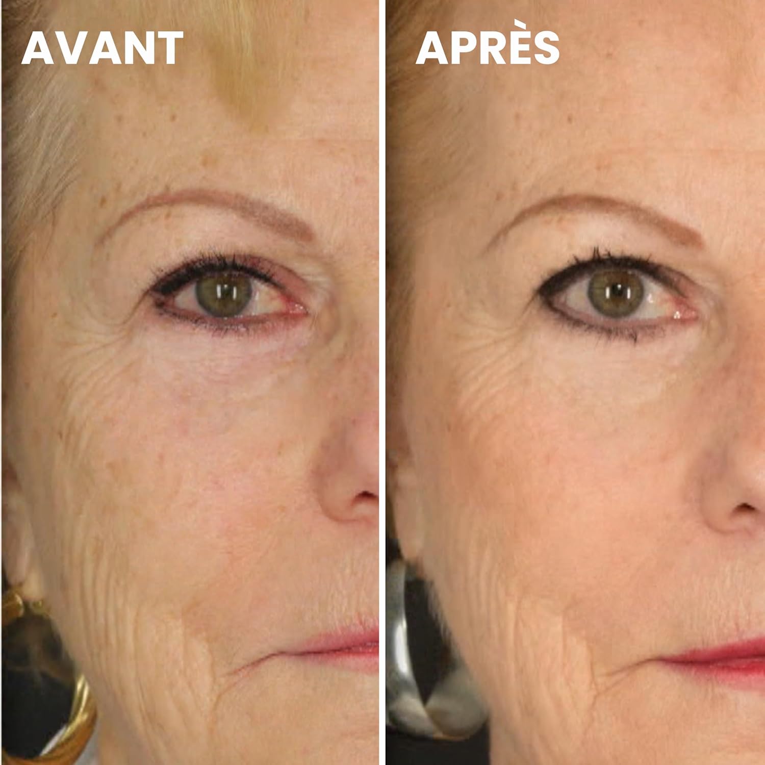Thumbnail 4 de KDERM K’DERM SCIENTIFIC PARIS Lifter Sérum Gel Réparateur anti-rides à la Kappa-Élastine et Aloe Vera – 30 ml