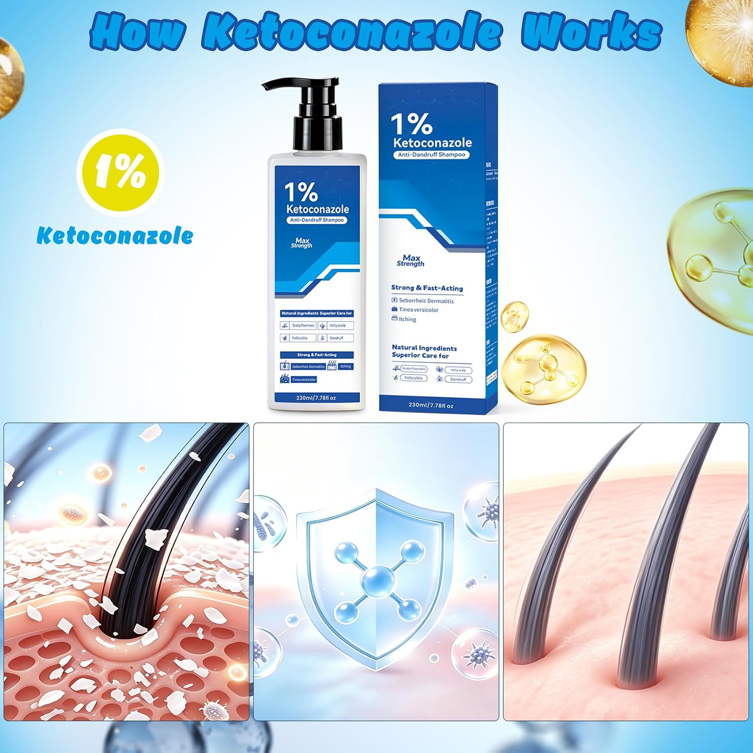 Detalle de 1% Ketoconazole Anti-Dandruff Shampoo, 7.78 fl oz for Itchy Scalp
