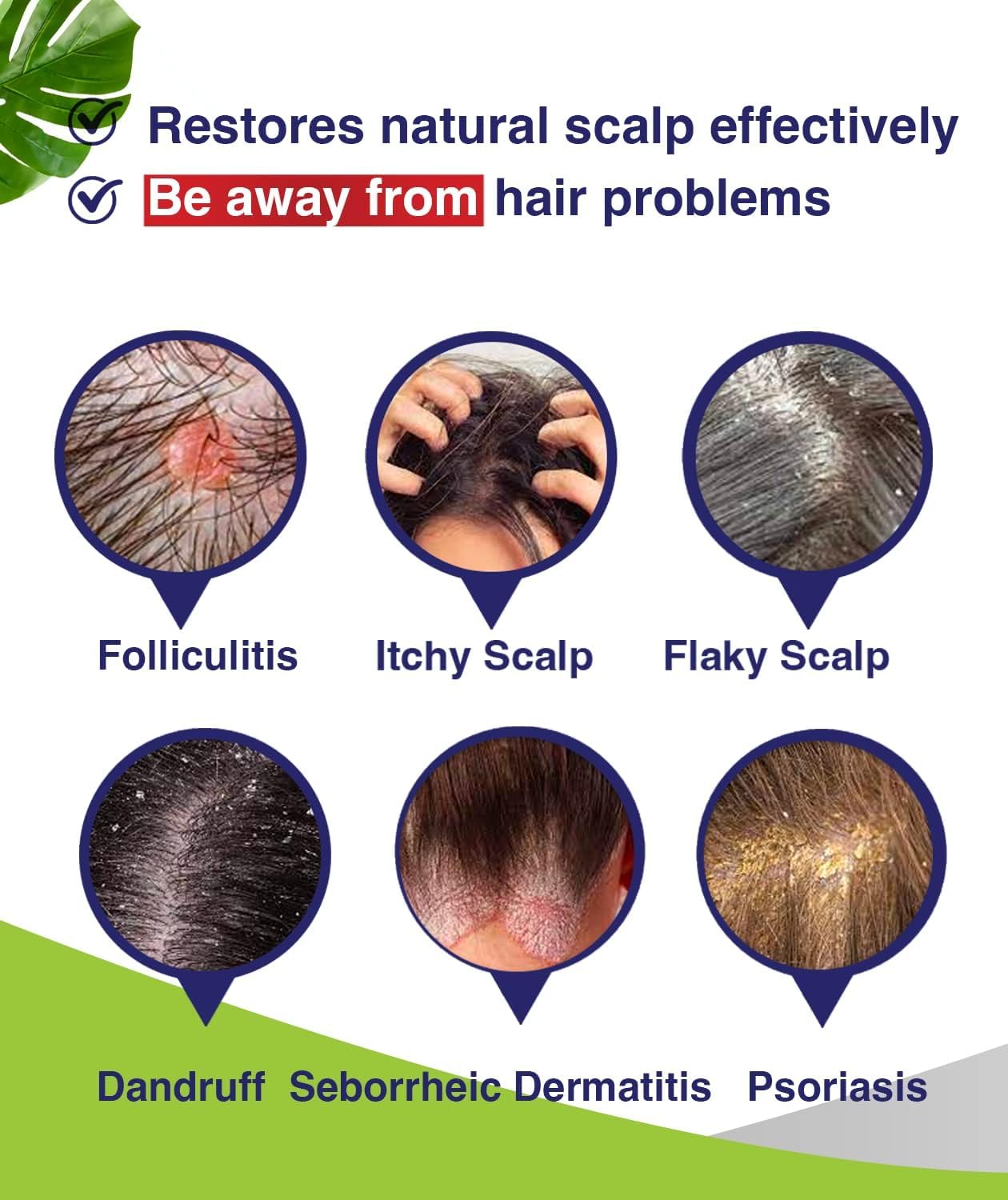 Detalle 2 de PHARMBANNER Anti-Fungal Shampoo for Scalp Psoriasis ⚙