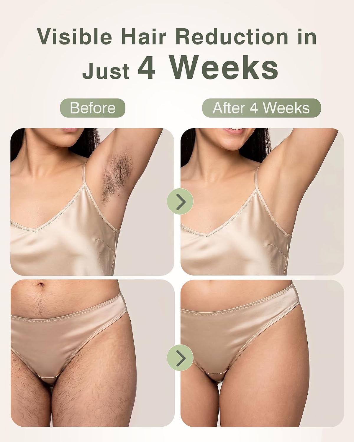 Detalle de TIIMAGIC IPL Laser Hair Removal Device for Home Use with Ice Cooling (9 Levels, 999,900 Flashes) - White