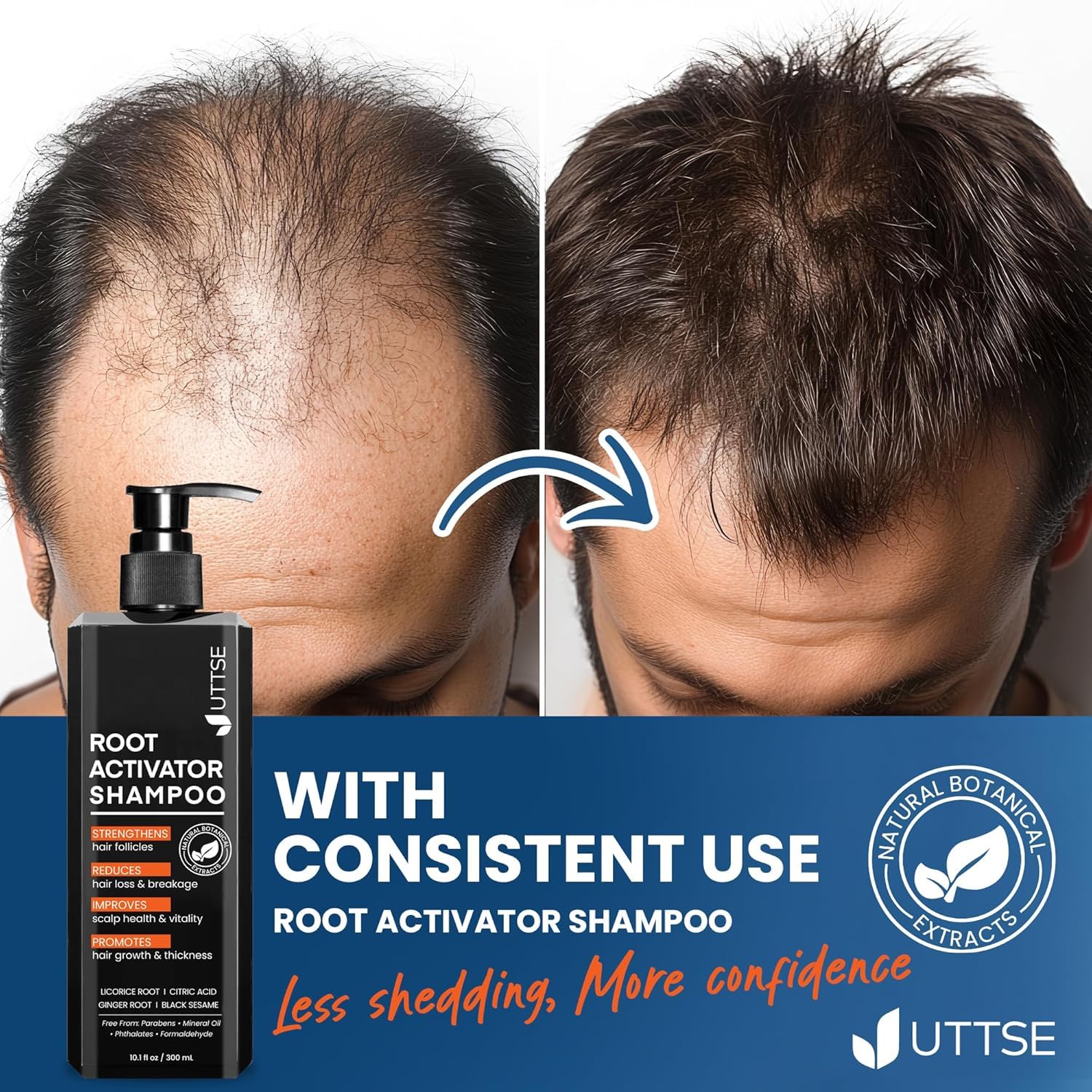 Thumbnail 5 de Root Activator Shampoo for Men: Hair Growth and Scalp Health
