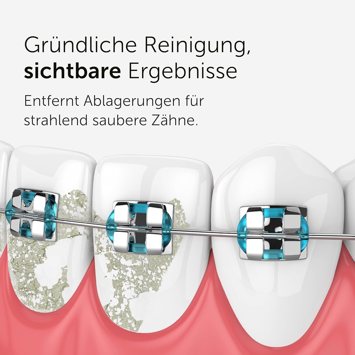 Thumbnail 3 de WonderSmile Orthodontic Düse – Ersatzdüsen für die Munddusche Waterflow (Black, 4er-Pack)