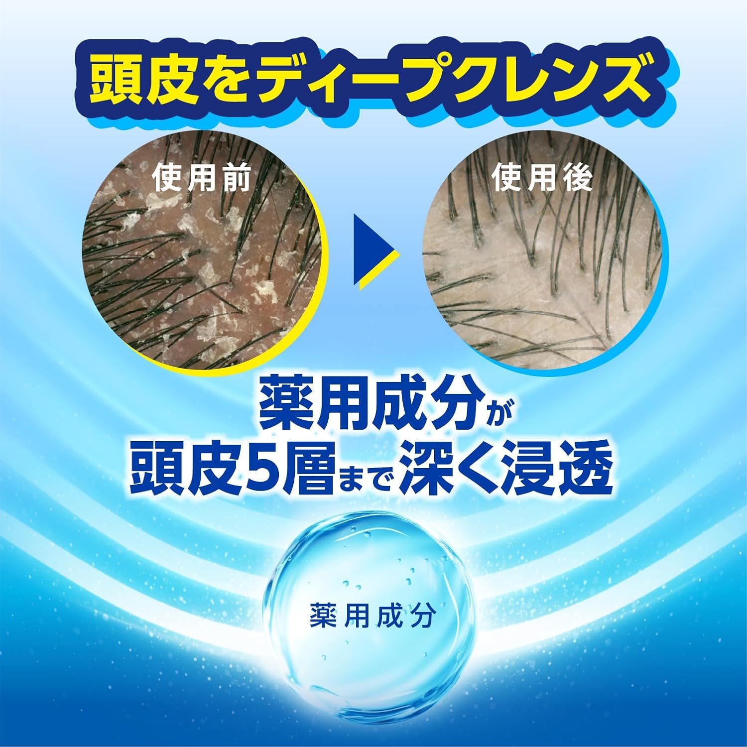 Detalle de h&s モイスチャー 薬用コンディショナー 詰替え 2.2kg、地肌のうるおいとしっとり髪に