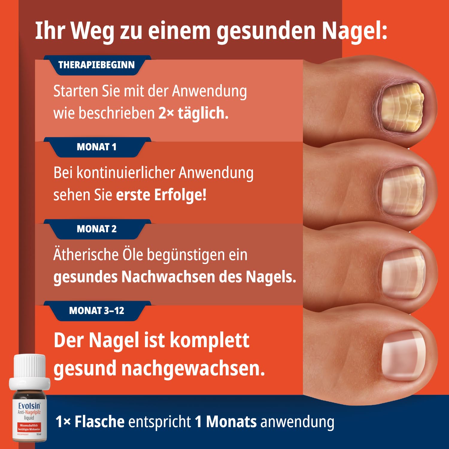 Thumbnail 6 de Evolsin® Anti-Nagelpilz Liquid – Medizinprodukt gegen Nagelpilz an Händen & Füßen, auch für Diabetiker