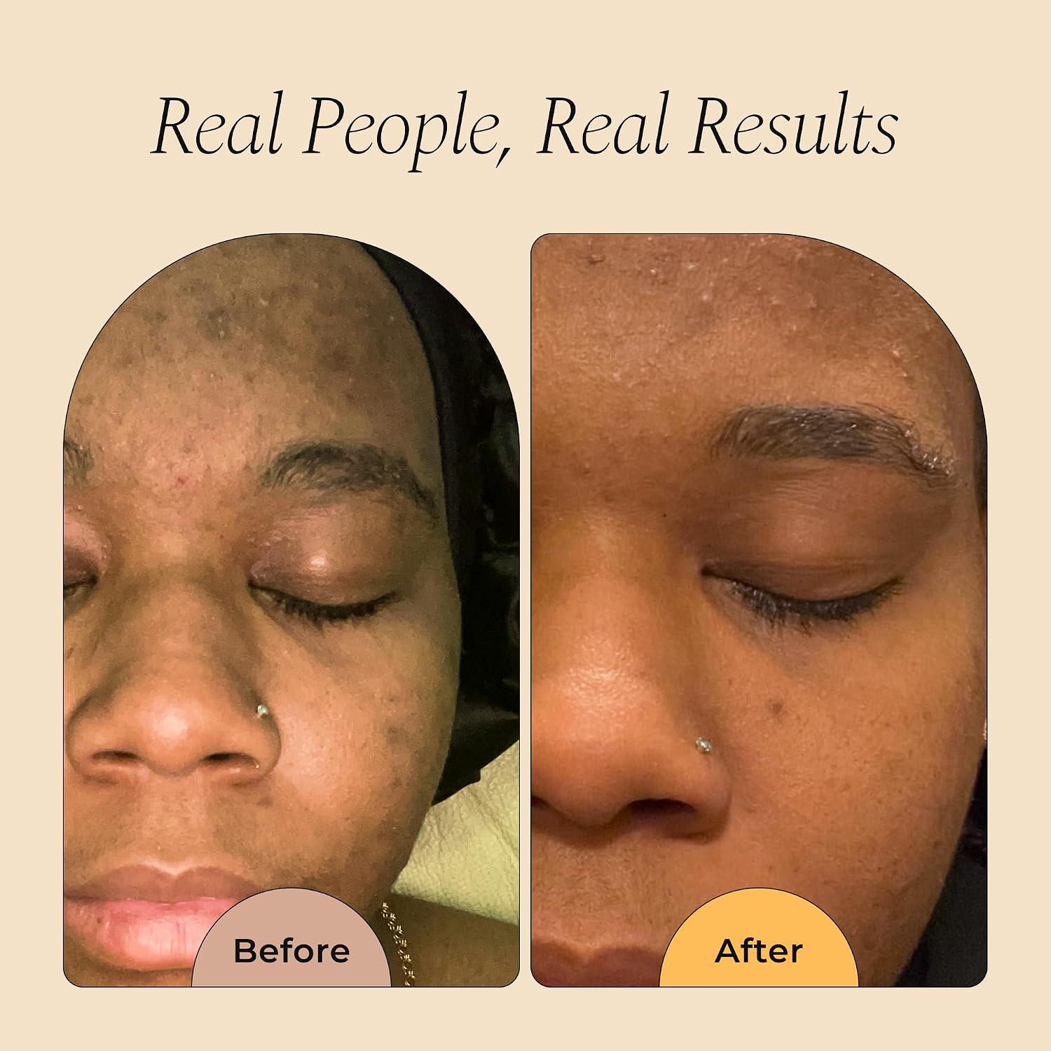 Detalle de Glo Melanin Turmeric Soap for Dark Spots