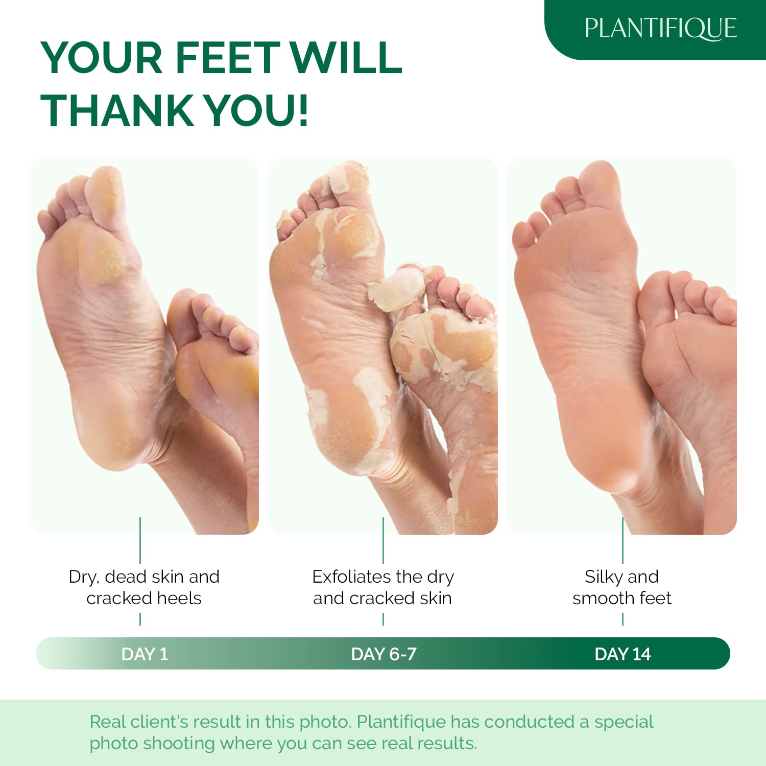 Detalle de PLANTIFIQUE Foot Peeling Mask 2 Pack for Men — Dermatologically Tested Exfoliating Foot Mask with Aloe Vera