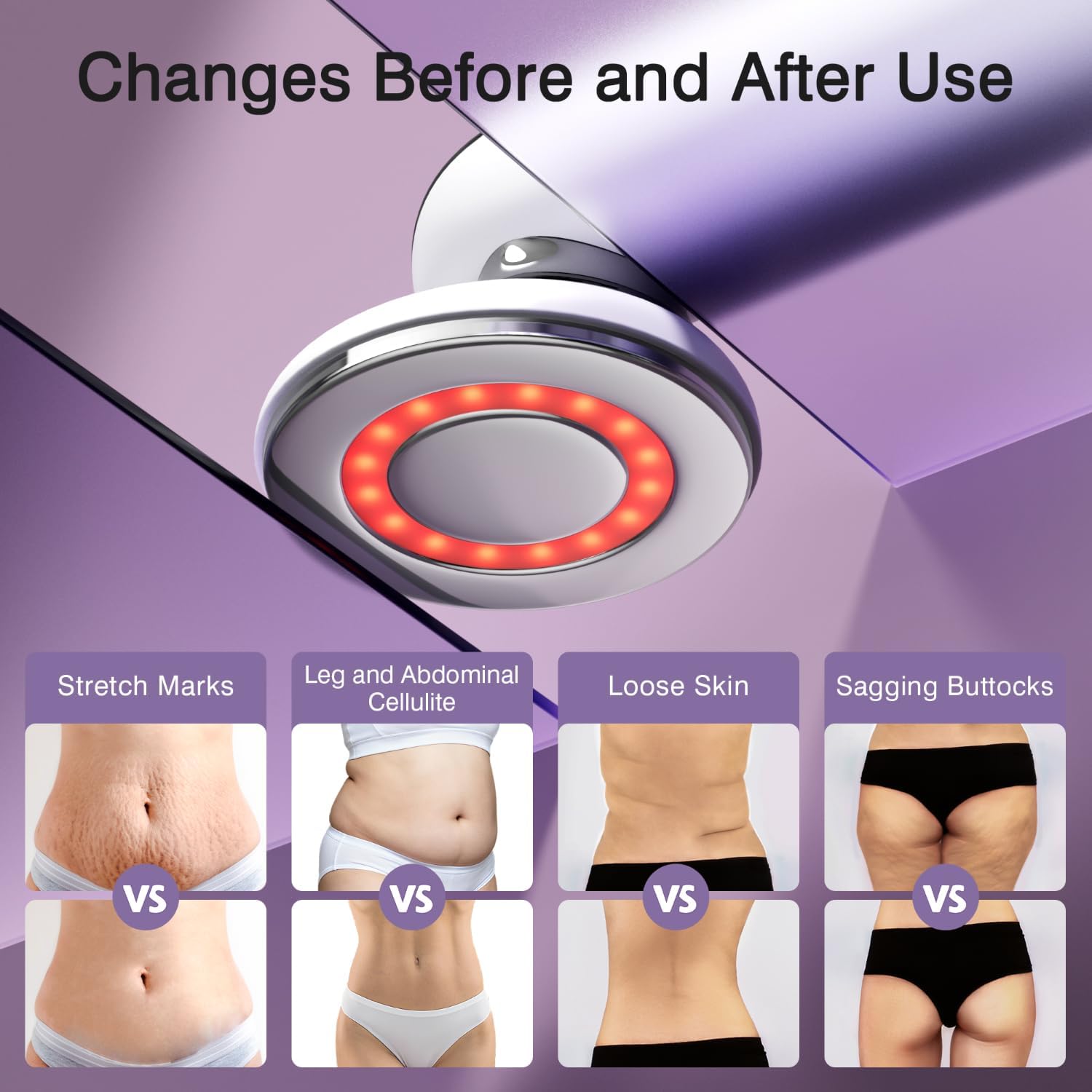 Thumbnail 5 de Cellulite Massager Tool: 4-in-1 Body Sculpting Machine (White)
