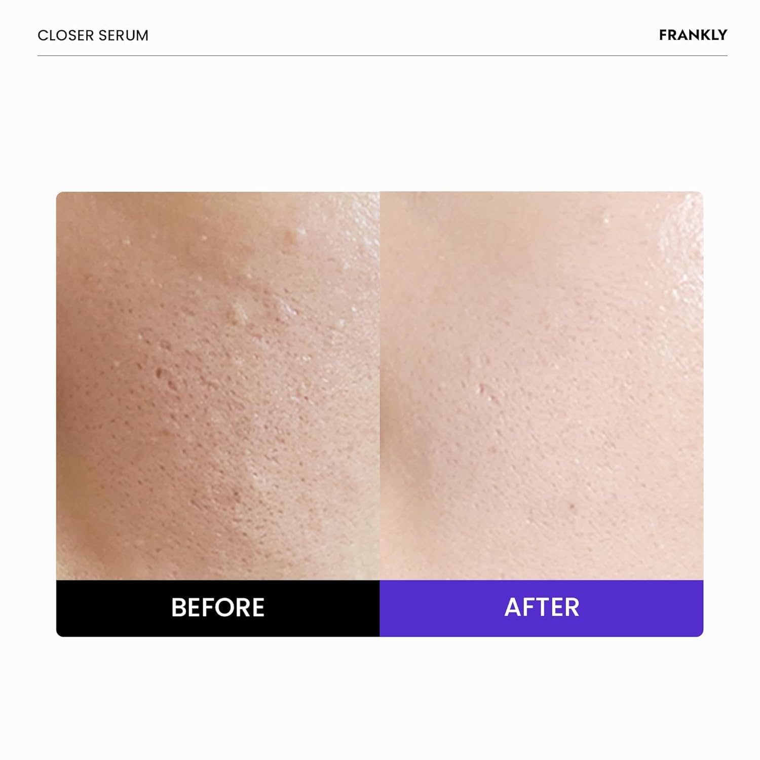 Detalle 2 de FRANKLY Closer Serum Pore Minimizer 1.01 fl oz