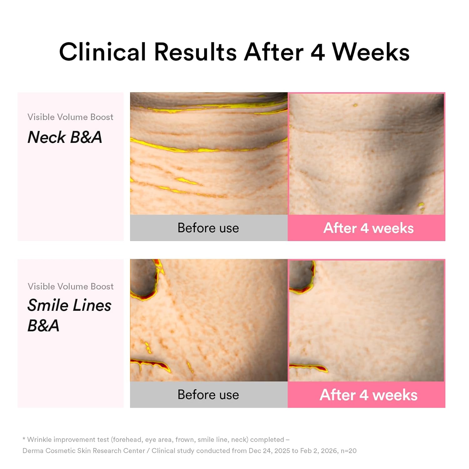 Thumbnail 5 de Abib PDRN Volume fill-it Booster Cream 2.5 tube (1.01 fl oz) for facial volume plumping