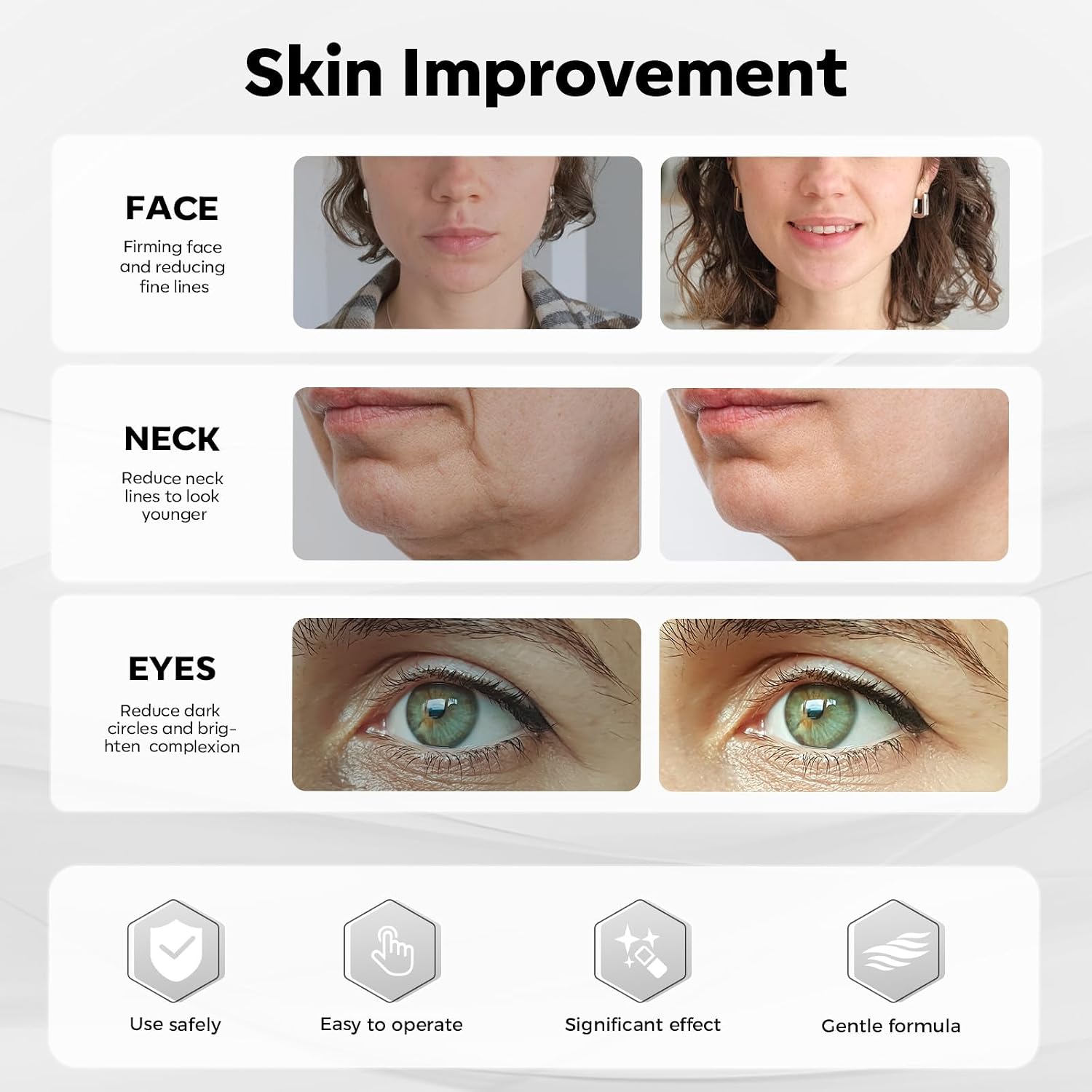 Thumbnail 6 de SHINING FACE Micro Infusion System for Face & Neck: 3-Month Kit with 0.25mm Stamp and Serum