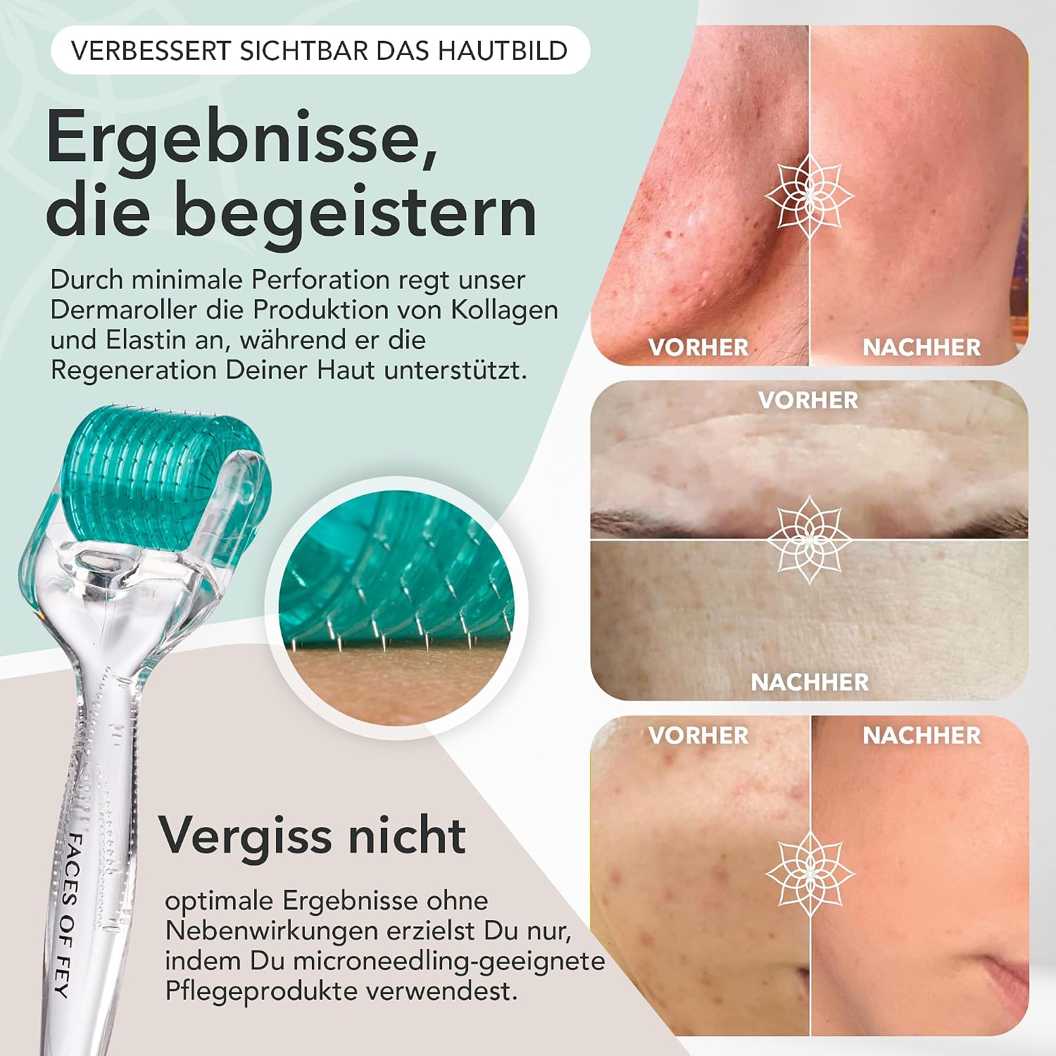 Detalle de Faces of Fey Dermaroller Gesicht 0,5 mm – 192 Nadeln aus Chirurgenstahl