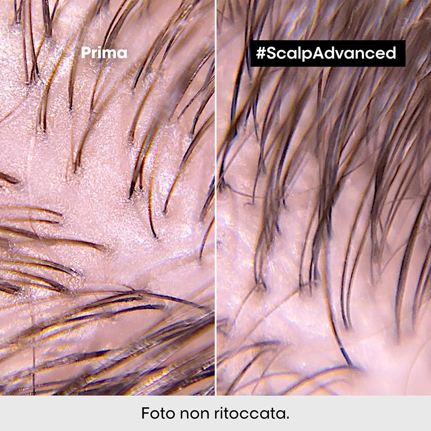 Thumbnail 3 de L'Oréal Professionnel Paris Shampoo Lenitivo Scalp Advanced al 3% AHA per cuoio capelluto grasso, effetto rinfrescante (500 ml)