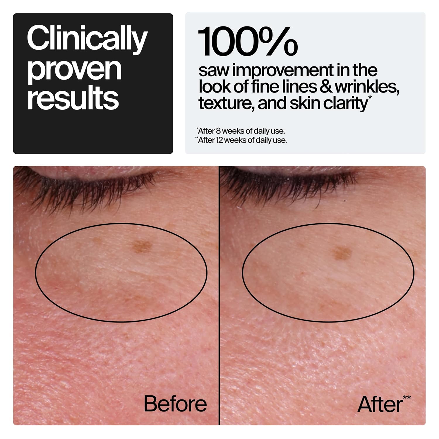 Thumbnail 2 de Rapid Wrinkle Repair Retinol Cream 1.7 oz