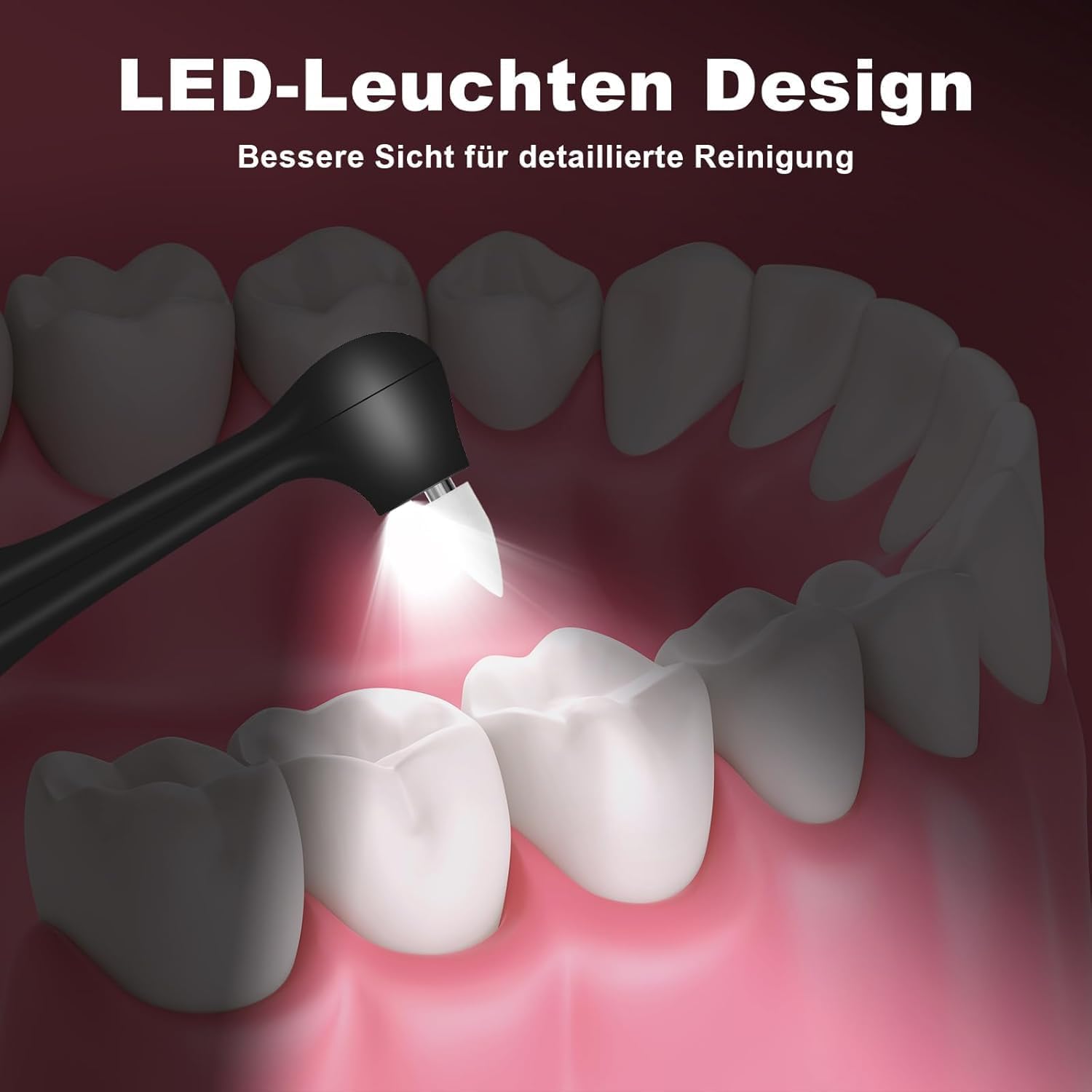 Thumbnail 4 de Zahnsteinentferner Zahnaufhellungsset Professionell