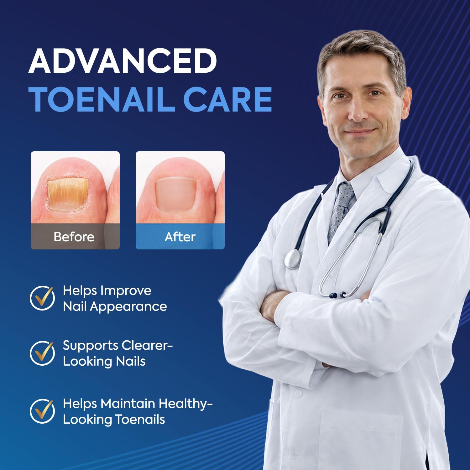 Detalle de Toenail fungus treatment pen with 25% undecylenic acid
