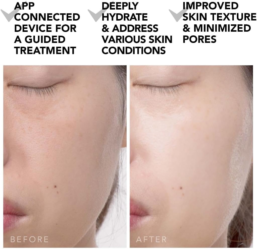 Thumbnail 4 de FOREO UFO 2: Máscara LED Facial con Crioterapia y Masaje 💆♀