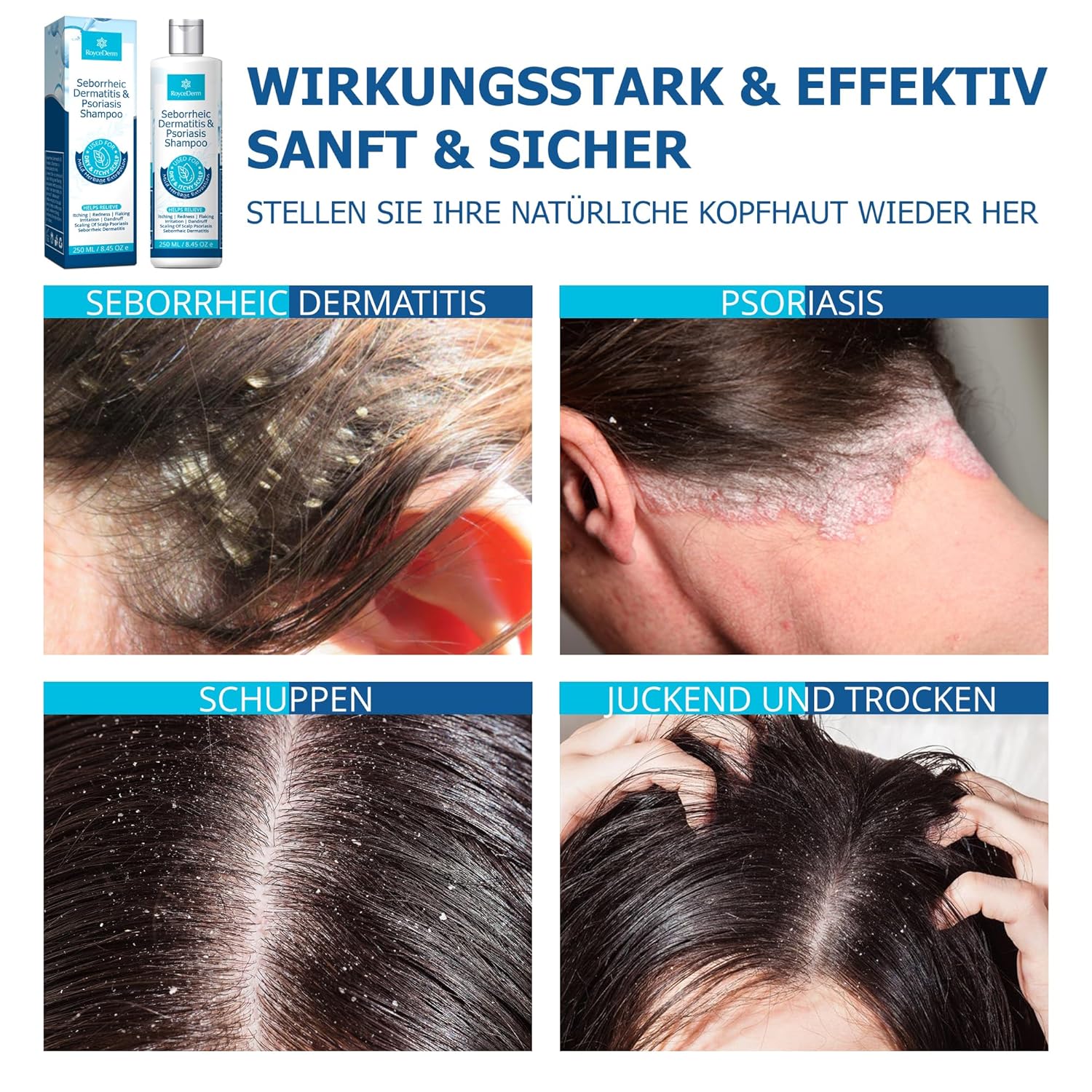 Thumbnail 3 de RoyceDerm Seborrhoisches Schuppenflechte Shampoo für Kopfhaut und Körper