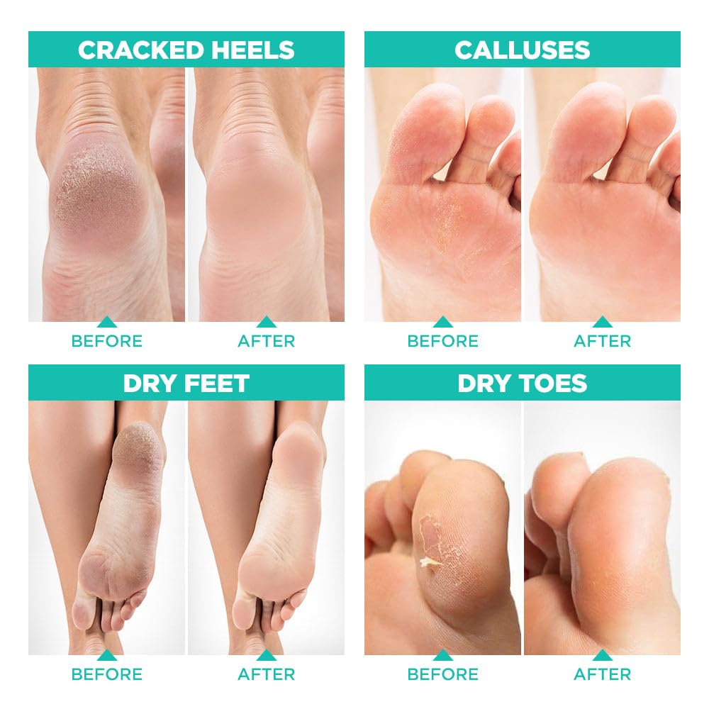 Detalle de Lavinso Foot Peel Mask – 2-Pack ⚙