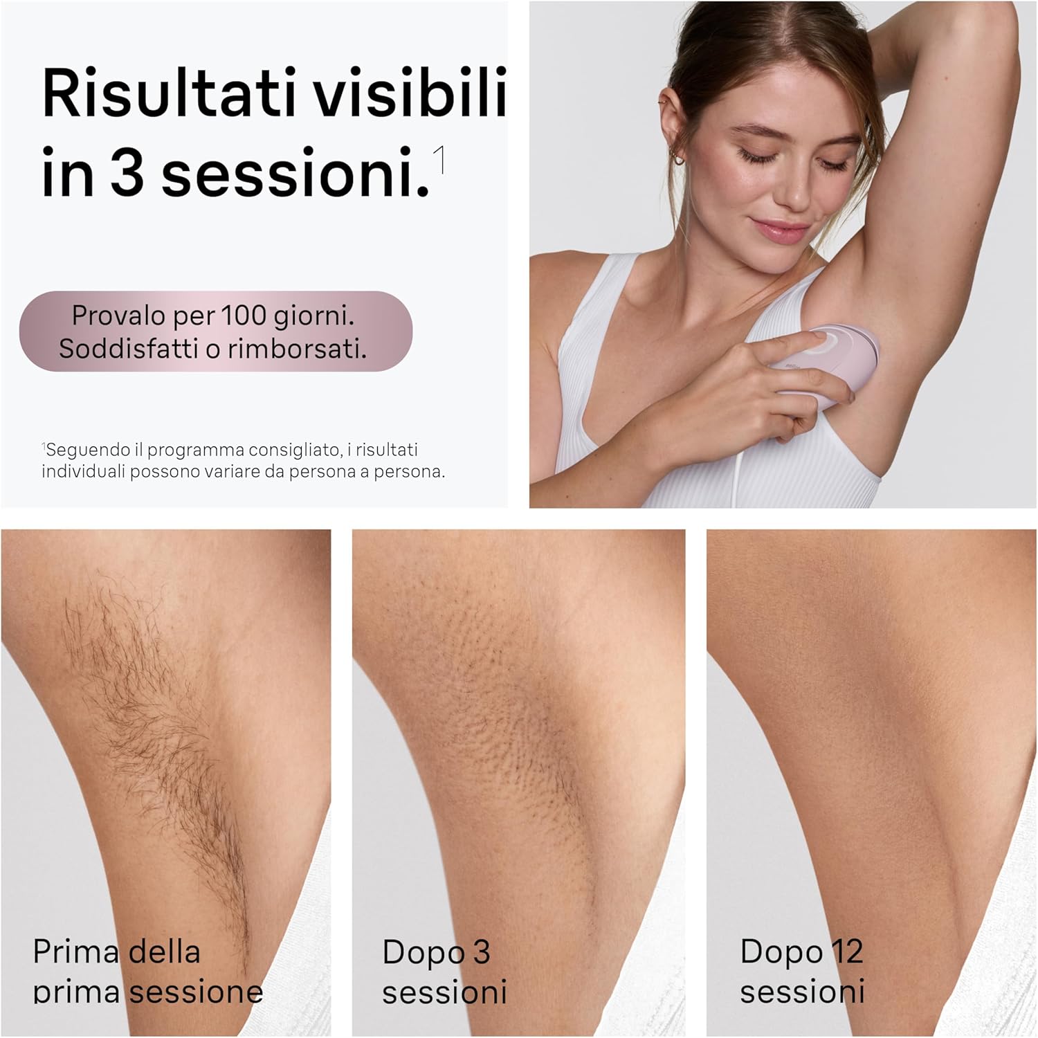 Detalle de Braun Silk·Expert Mini Smart PL1112 – epilatore a luce pulsata per donna, depilazione e riduzione dei peli a casa