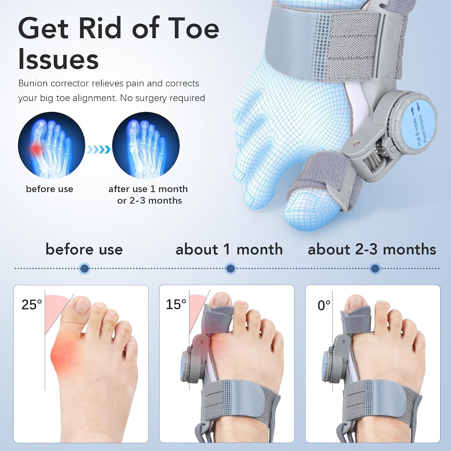 Detalle 2 de VEVARUN Bunion Corrector