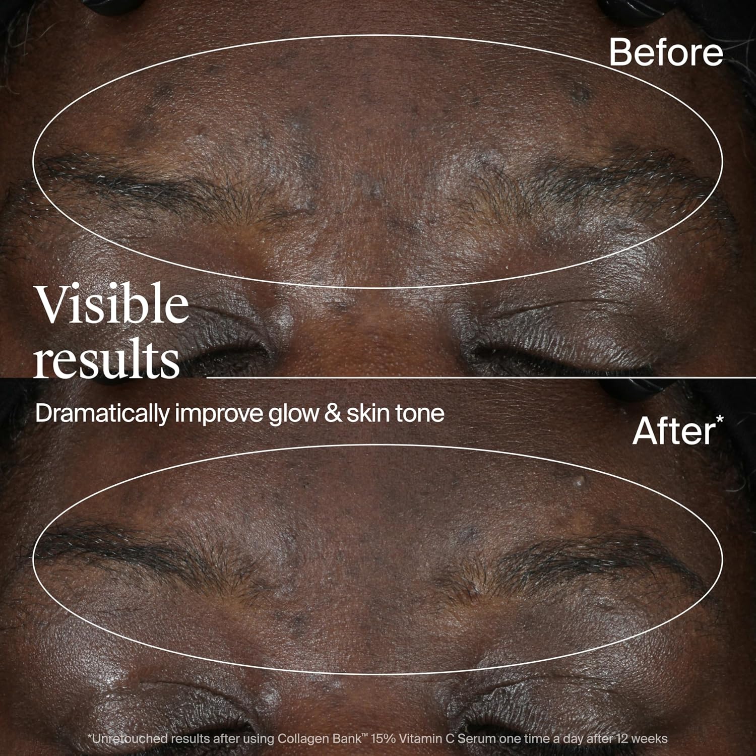 Thumbnail 4 de Neutrogena Collagen Bank 15% Vitamin C Serum
