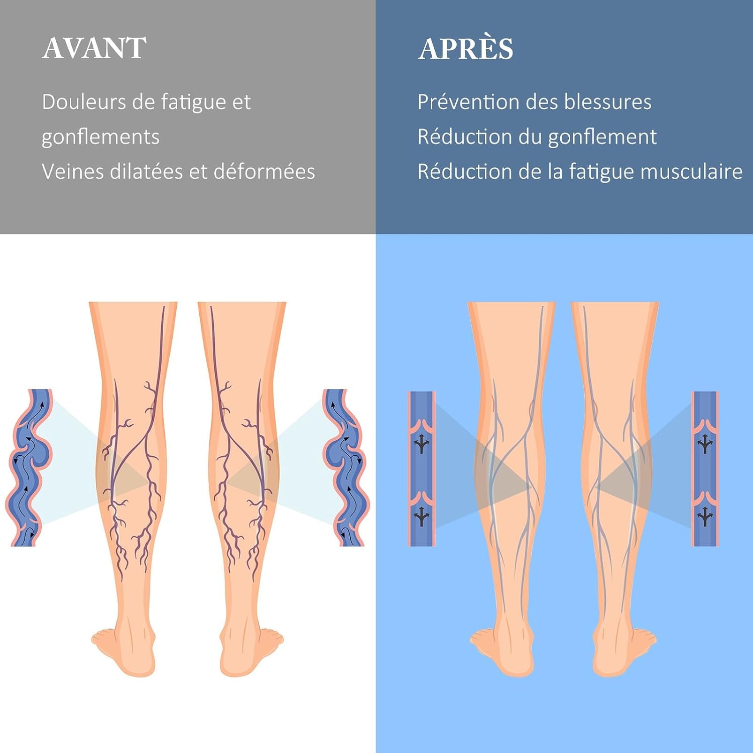Detalle de ZFSOCK Bas de contention grande taille à fermeture éclair – 20–30 mmHg, bout ouvert