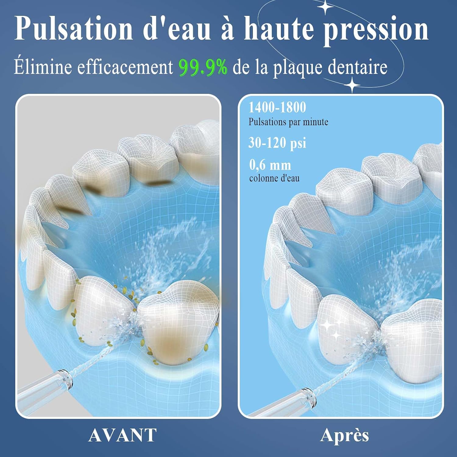 Detalle de SURFOU Jet Dentaire Hydropulseur Professionnel – Irrigateur dentaire alimenté par USB