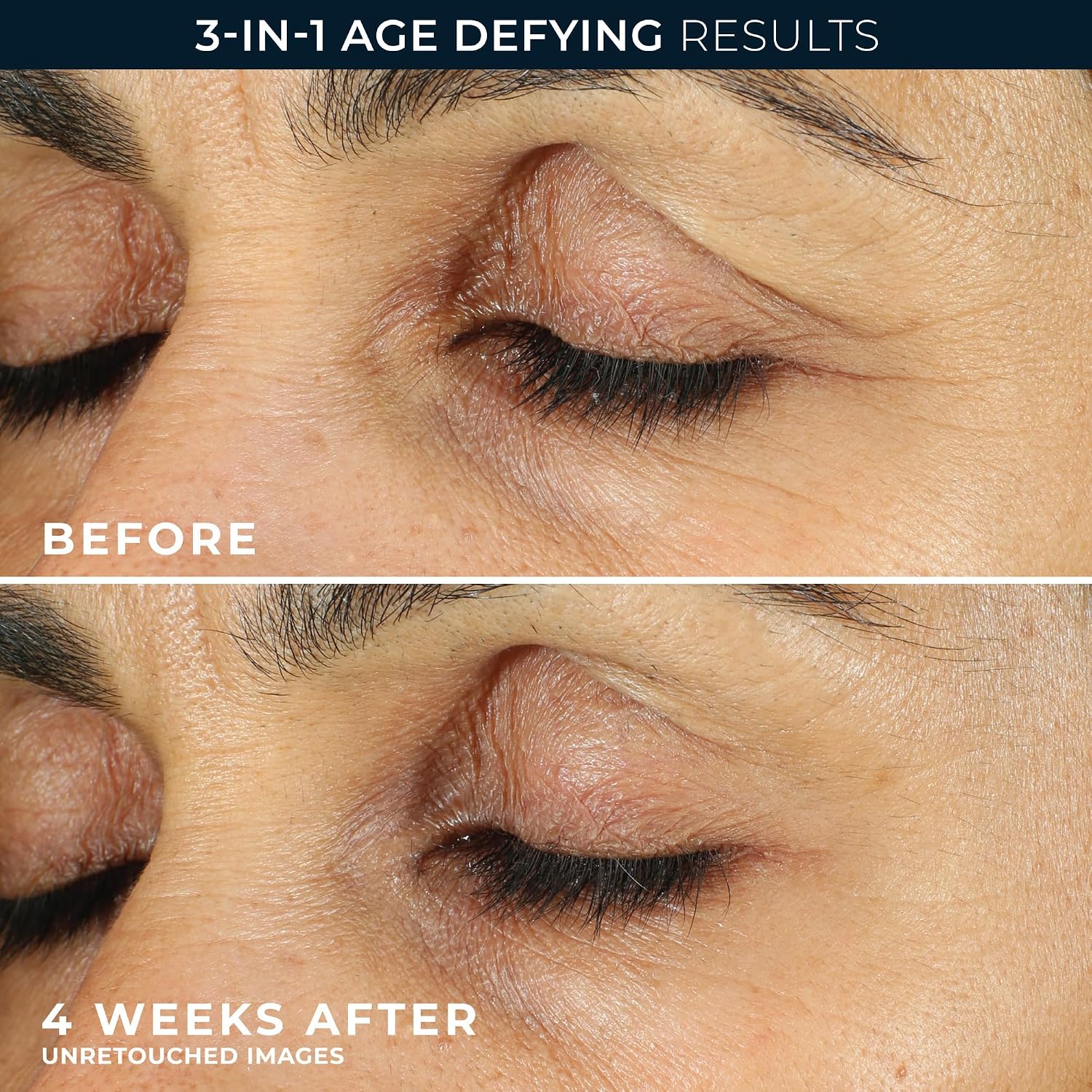 Detalle de RoC Retinol Correxion Under Eye Cream for Dark Circles, Puffiness & Wrinkles