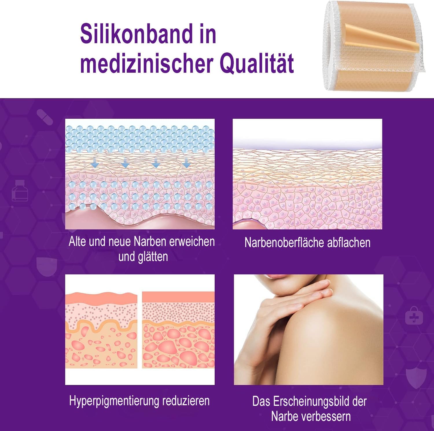 Detalle de 1.5M Fogli di silicone cicatrici – fornitura di 6 mesi, riutilizzabili e delicati sulla pelle