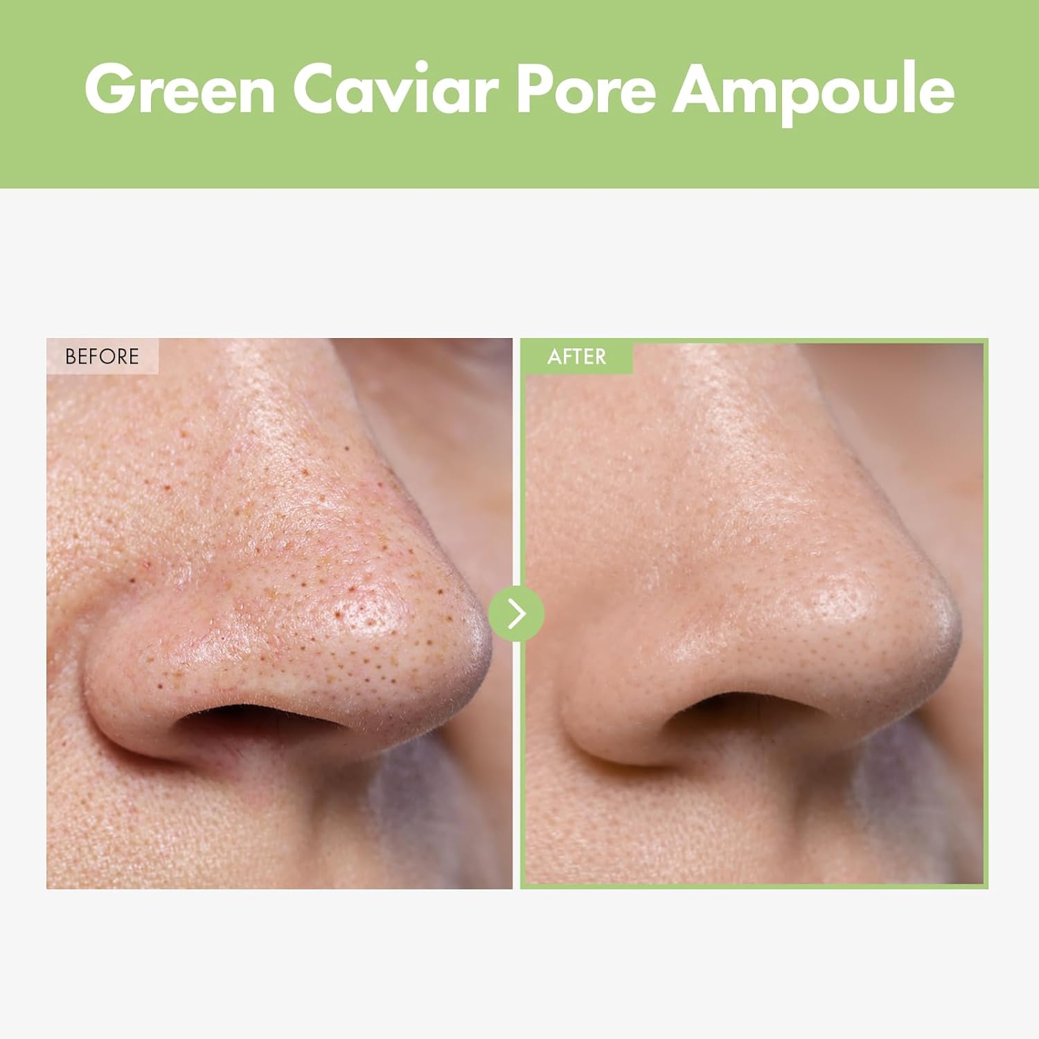 Detalle de TOSOWOONG Siero ai Caviali Verdi per i Pori con 2.500ppm di Caviale Verde, niacinamide e minimizzatore dei pori (33 ml)
